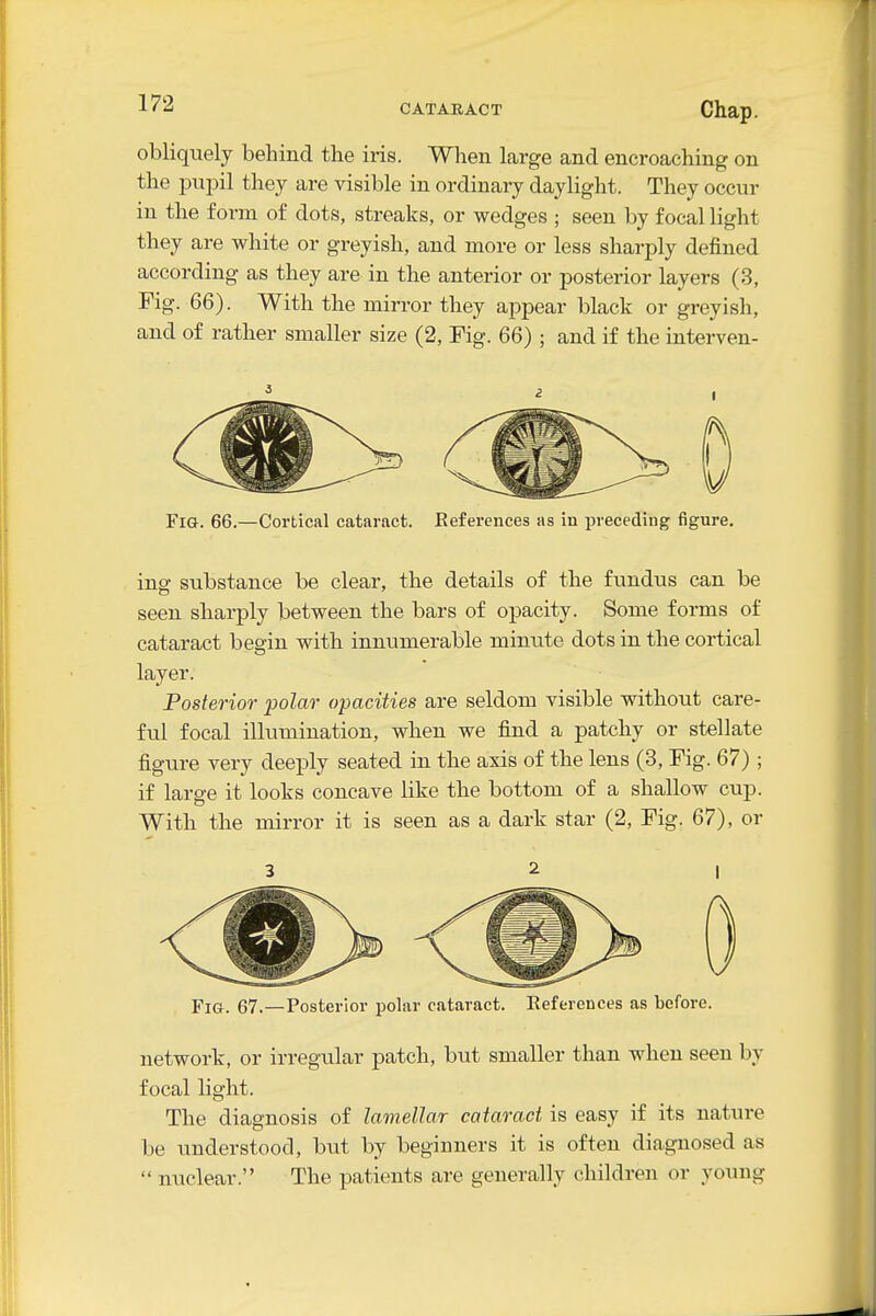 obliquely behind the iris. When large and encroaching on the pupil they are visible in ordinary daylight. They occur in the form of dots, streaks, or wedges ; seen by focal light they are white or greyish, and more or less sharply defined according as they are in the anterior or posterior layers (3, Fig. 66). With the mirror they appear black or greyish, and of rather smaller size (2, Fig. 66) ; and if the interven- Fia. 66.—Cortical cataract. Keferences as in preceding figure. ins: substance be clear, the details of the fundus can be seen sharply between the bars of opacity. Some forms of cataract begin with innumerable minute dots in the cortical layer. Posterior polar opacities are seldom visible without care- ful focal illumination, when we find a patchy or stellate figure very deeply seated in the axis of the lens (3, Fig. 67) ; if large it looks concave like the bottom of a shallow cup. With the mirror it is seen as a dark star (2, Fig. 67), or Fig. 67.—Posterior polar cataract. References as before. network, or irregular patch, but smaller than when seen by focal light. The diagnosis of lamellar cataract is easy if its nature be understood, but by beginners it is often diagnosed as  nuclear. The patients are generally children or young