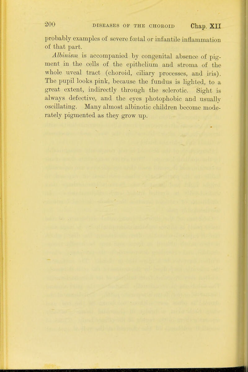 probably examples of severe foetal or infantile inflammation of that part. Albinism is accompanied by congenital absence of pig- ment in the cells of the epithelium and stroma of the whole uveal tract (choroid, ciliary processes, and iris). The pupil looks pink, because the fundus is lighted, to a great extent, indirectly through the sclerotic. Sight is always defective, and the eyes photophobic and usually oscillating. Many almost albinotic children become mode- rately pigmented as they grow up.