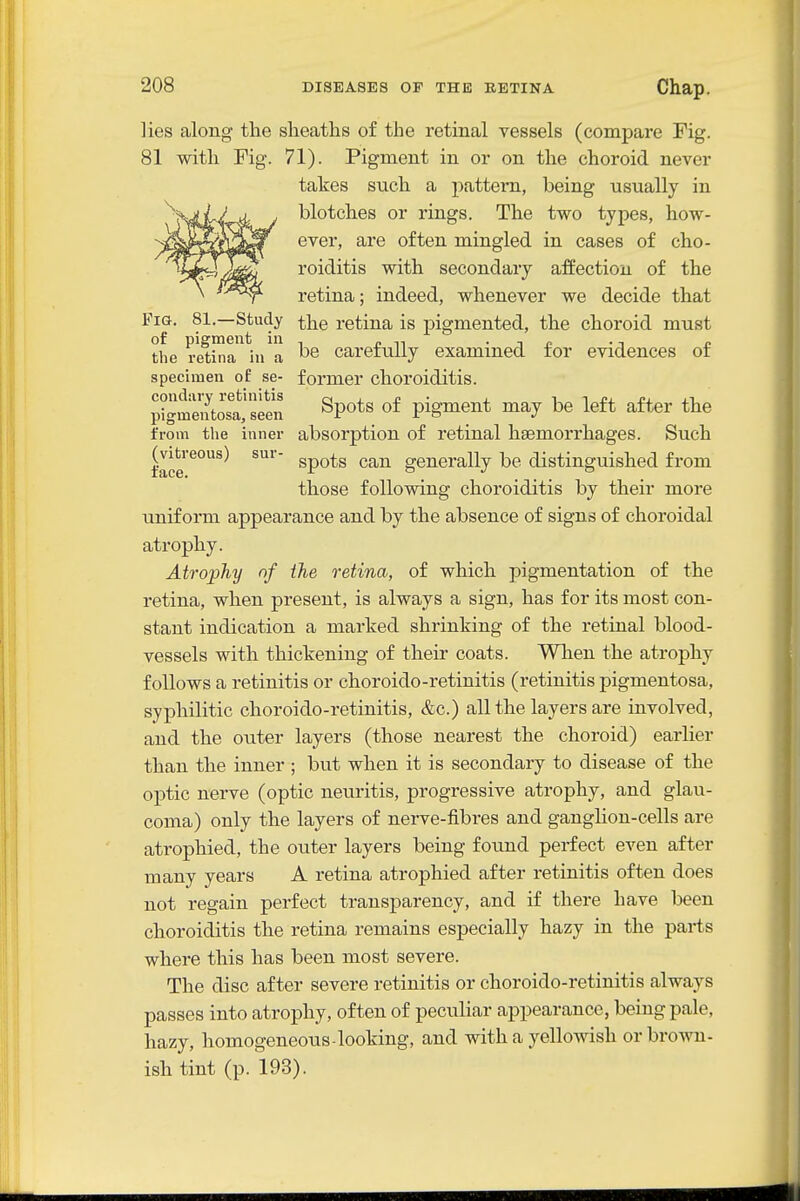 lies along the sheaths of the retinal vessels (compare Fig. 81 with Fig. 71). Pigment in or on the choroid never takes such a pattern, being usually in blotches or rings. The two types, how- ever, are often mingled in cases of cho- roiditis with secondary affection of the retina; indeed, whenever we decide that Fig. 81.—Study the retina is pigmented, the choroid must the re^ina*ii/a carefully examined for evidences of specimen of se- former choroiditis. pigmen^Sse^^^^ ^P°*^ pigment may be left after the from the inner absorption of retinal haemorrhages. Such face^°^^ ^P*^*^ ^^^^ generally be distinguished from those following choroiditis by their more uniform appearance and by the absence of signs of choroidal atrophy. Atrophy of the retina, of which pigmentation of the retina, when present, is always a sign, has for its most con- stant indication a marked shrinking of the retinal blood- vessels with thickening of their coats. When the atrophy follows a retinitis or choroido-retinitis (retinitis pigmentosa, syphilitic choroido-retinitis, &c.) all the layers are involved, and the outer layers (those nearest the choroid) earlier than the inner ; but when it is secondary to disease of the optic nerve (optic neuiitis, progressive atrophy, and glau- coma) only the layers of nerve-fibres and ganglion-cells are atrophied, the outer layers being fotind perfect even after many years A retina atrophied after retinitis often does not regain perfect transparency, and if there have been choroiditis the retina remains especially hazy in the parts where this has been most severe. The disc after severe retinitis or choroido-retinitis always passes into atrophy, often of peculiar appearance, being pale, hazy, homogeneous-looking, and with a yellowish or brown- ish tint (p. 193).