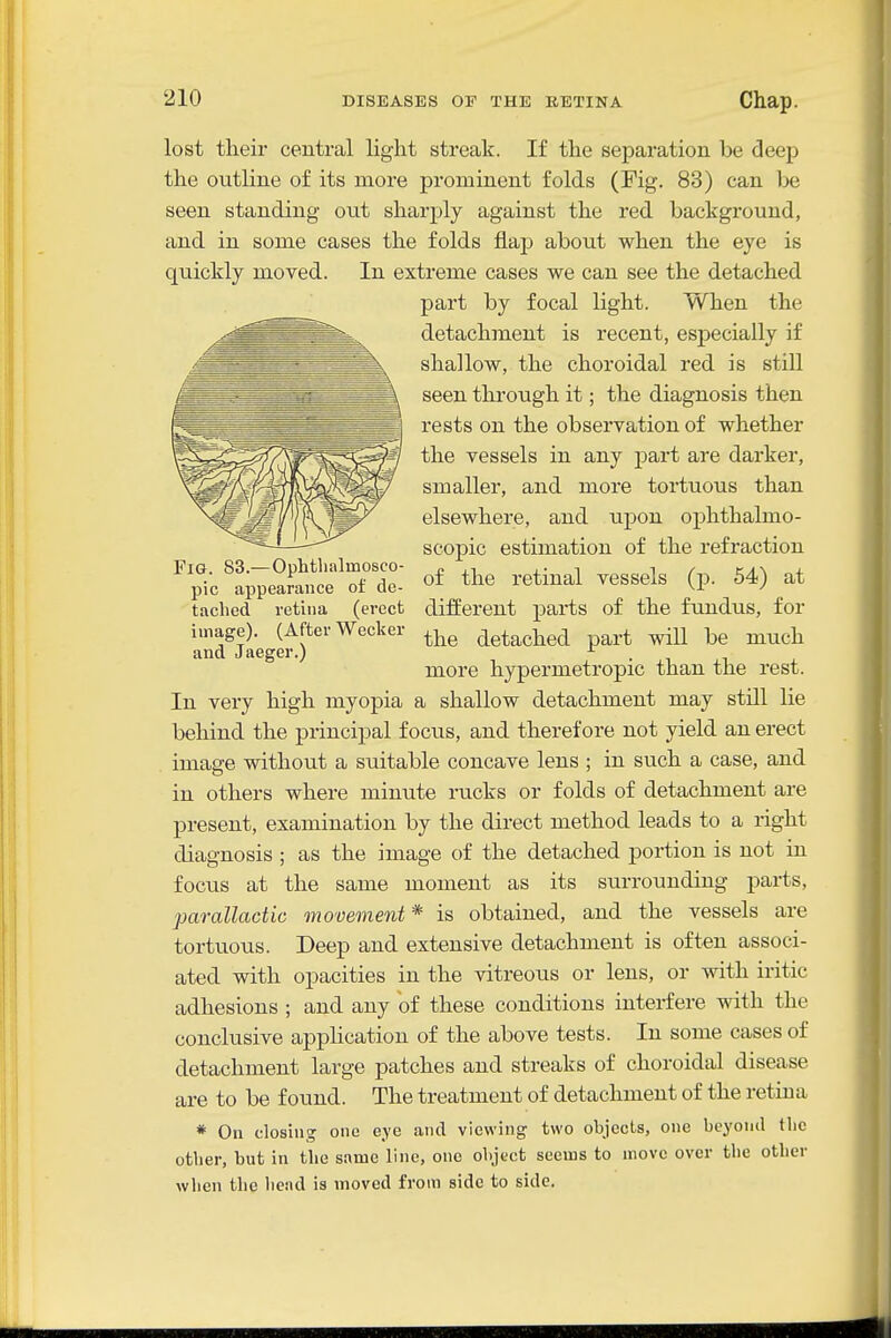 lost their central light streak. If the separation be deep the outline of its more prominent folds (Fig. 83) can be seen standing out sharply against the red background, and in some cases the folds flap about when the eye is quickly moved. In extreme cases we can see the detached part by focal light. When the detachment is recent, esj)ecially if shallow, the choroidal red is still seen through it; the diagnosis then rests on the observation of whether the vessels in any part are darker, smaller, and more tortuous than elsewhere, and upon ophthalmo- scopic estimation of the refraction of the retinal vessels (p. 54) at different parts of the fundus, for the detached part will be much more hypermetropic than the rest. In very high myopia a shallow detachment may still lie behind the principal focus, and therefore not yield an erect image without a suitable concave lens ; in such a case, and in others where minute rucks or folds of detachment are present, examination by the direct method leads to a right diagnosis ; as the image of the detached portion is not in focus at the same moment as its surrounding parts, parallactic movement* is obtained, and the vessels are tortvious. Deep and extensive detachment is often associ- ated with opacities in the vitreous or lens, or with iritic adhesions ; and any of these conditions interfere with the conclusive application of the above tests. In some cases of detachment large patches and streaks of choroidal disease are to be found. The treatment of detachment of the retina * On closing one eye and viewing two objects, one beyond tlic other, but in the same line, one object seems to move over the other when the hend is moved from side to side. Fig. 83.—Ophthalmosco- pic appearance of de- tached retina (erect image). (After Weeker and Jaeger.)