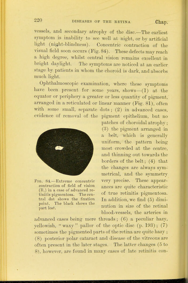 vessels, and secondary atrophy of the disc.—The earliest symptom is inability to see well at night, or by artificial light (night-blindness). Concentric contraction of the visual field soon occurs (Fig. 84). These defects may reach a high degree, whilst central vision remains excellent in bright daylight. The symptoms are noticed at an earlier stage by patients in whom the choroid is dark, and absorbs much light. Ophthalmoscopic examination, where these symptoms have been present for some years, shows—(1) at the equator or periphery a greater or less quantity of pigment, arranged in a reticulated or linear manner (Fig. 81), often with some small, separate dots ; (2) in advanced cases, evidence of removal of the pigment epithelium, but no patches of choroidal atrophy ; (3) the pigment arranged in a belt, which is generally xmiform, the pattern being most crowded at the centre, and thinning out towards the borders of the belt; (4) that the changes are always sym- metrical, and the symmetrj^ very precise. These appear- ances are quite characteristic of ti-ue retinitis pigmentosa. In addition, we find (5) dimi- nution in size of the retinal blood-vessels, the arteries in advanced cases being mere threads ; (6) a peculiar hazy, yellowish, waxy pallor of the optic disc (p. 193); (7) sometimes the pigmented parts of the retina are quite hazy ; (8) posterior polar cataract and disease of the vitreous are often present in the later stages. The latter changes (5 to 8), however, are found in many cases of late retinitis con- FiG. 81..—Extreme concentric contraction of field of vision (II.) in a case of advanced re- tinitis pigmentosa. Tliecen- triil dot sliows the fixation point. The black sliows the part lost.