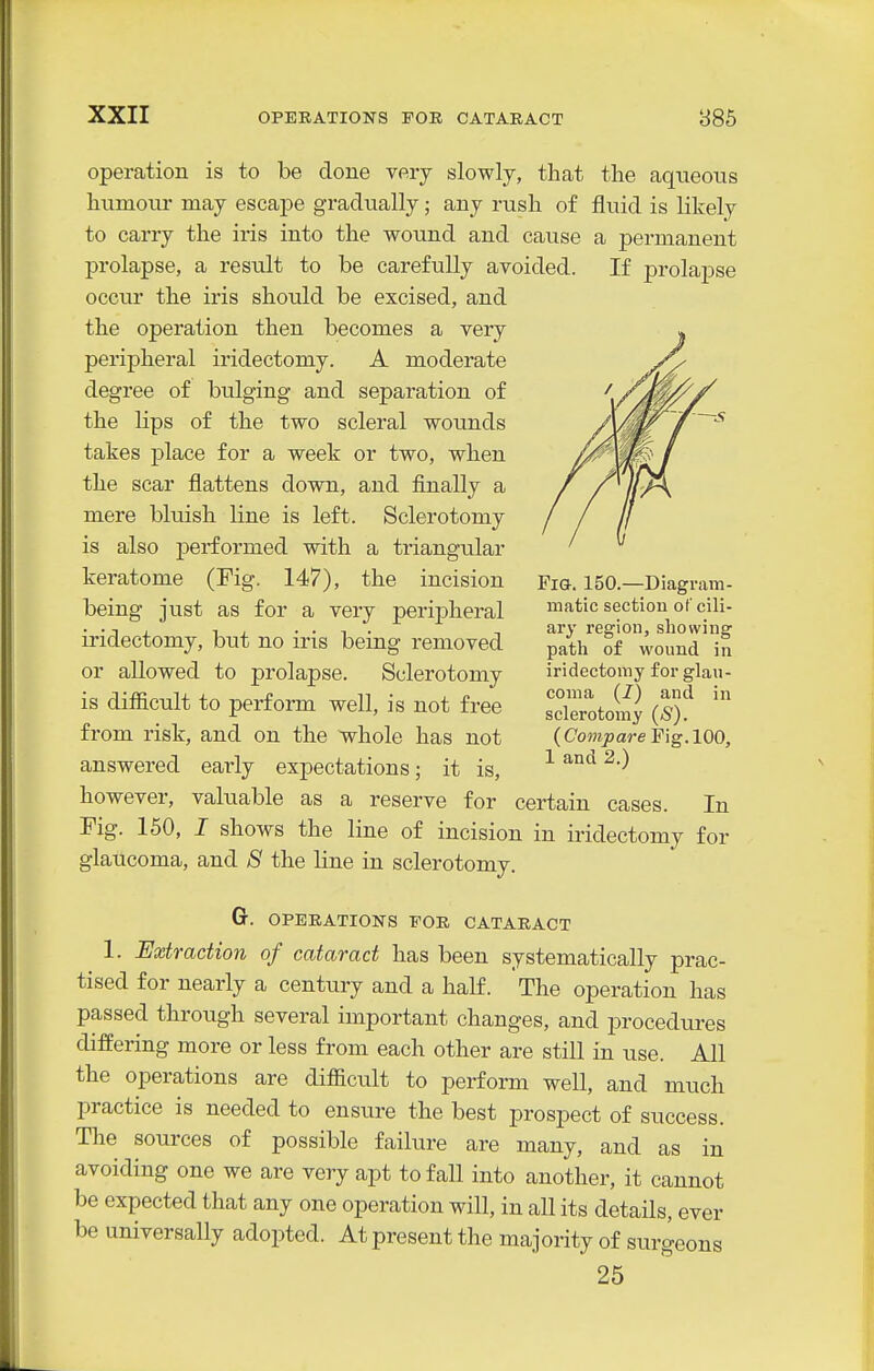 operation is to be done very slowly, that the aqueous humotu- may escape gradually; any rush of fluid is likely to carry the iris into the wound and cause a permanent prolapse, a result to be carefully avoided. If prolapse occur the iris should be excised, and the operation then becomes a very peripheral iridectomy. A moderate degree of bulging and separation of the lips of the two scleral wounds takes place for a week or two, when the scar flattens down, and finally a mere bluish line is left. Sclerotomy is also performed with a triangular keratome (Pig. 147), the incision being just as for a very peripheral iridectomy, but no iris being removed or allowed to prolapse. Sclerotomy is difiicult to perform well, is not free from risk, and on the whole has not answered early expectations; it is, however, valuable as a reserve for certain cases. In Fig. 150, I shows the line of incision in iridectomy for glaucoma, and 8 the line in sclerotomy. G. OPERATIONS FOR CATARACT 1. Extraction of cataract has been systematically prac- tised for nearly a century and a half. The operation has passed through several important changes, and procedures differing more or less from each other are still in use. All the operations are difficult to perform well, and much practice is needed to ensure the best prospect of success. The sources of possible failure are many, and as in avoiding one we are very apt to fall into another, it cannot be expected that any one operation will, in all its details, ever be universally adopted. At present the majority of surgeons 25 Fig. 150.—Diagram- matic section of cili- ary I'egion, showing patli of wound in iridectomy for glau- coma (I) and in sclerotomy (S). ( Compare Pig. 100,