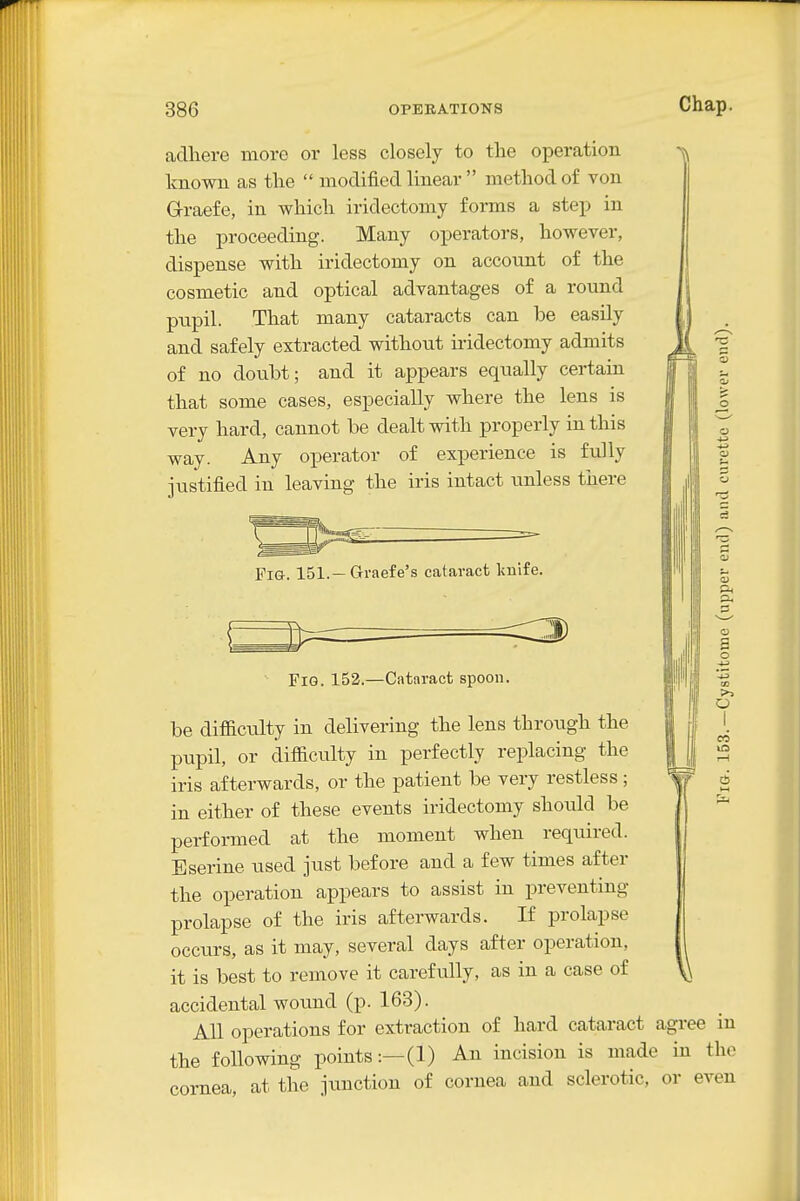 adhere more or less closely to the operation Imown as the  modified linear  method of von Graefe, in which iridectomy forms a step in the proceeding. Many operators, however, dispense with iridectomy on account of the cosmetic and optical advantages of a round pupil. That many cataracts can be easily and safely extracted without iridectomy admits of no doubt; and it appears equally certain that some cases, especially where the lens is very hard, cannot be dealt with properly in this way. Any operator of experience is fully justified in leaving the iris intact unless there I Pig. 151.—Gri-aefe's cataract kulfe. Fig. 152.—Cataract spoon. \ s o o be difficulty in delivering the lens through the pupil, or difficulty in perfectly replacing the iris afterwards, or the patient be very restless ; in either of these events iridectomy should be performed at the moment when required. Eserine used just before and a few times after the operation appears to assist in preventing prolapse of the iris afterwards. If prolapse occurs, as it may, several days after operation, it is best to remove it carefully, as in a case of accidental wound (p. 163). All operations for extraction of hard cataract agree in the following points:—(1) An incision is made in the cornea, at the junction of cornea and sclerotic, or even