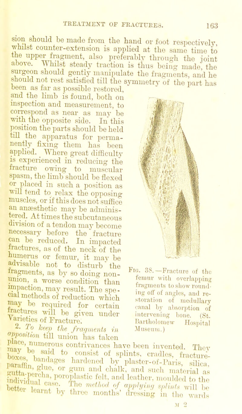 sion should be made from the hand or foot respectively whilst counter-extension is applied at the same time to the upper fragment, also preferably through the ioint above. Whilst steady traction is thus being made the surgeon should gently manipulate the fragments, and he should not rest satished till the symmetry of the part has been as far as possible restored, and the limb is found, both on inspection and measurement, to correspond as near as may be with the opposite side. In this position the parts should be held tm the apparatus for perma- nently fixing them has been applied. Where great difficulty is experienced in reducing the fracture owing to muscular spasm, the limb should be flexed or placed in such a position as will tend to relax the opposing muscles, or if this does not suffice an anaesthetic may be adminis- tered. At times the subcutaneous division of a tendon may become necessary before the fracture can be reduced. In impacted fractures, as of the neck of the humerus or femiu-, it may be advisable not to disturb' the iragments, as by so doing non- union, a worse condition than impaction, may result. The spe- cial methods of reduction which may be required for certain ftactures will be given under vanoties of Fracture. 2. To keep the fraqmmts in opposition till union has taken place, numerous contrivances have been invented. Thov S \ '''''^ f'^^^^'^t i' ■'^Pli'^t^- cradles, fracture- m?Sn '7'^'^ ■'^''^ ^^^^•^•^ I'l-ter-of-raHs, s li ,t CtK If '>^'}'^ '■lialk. and sucli material a fnE; T'''' Pi'«Pl'i«tic felt, and leather, moukled to the Pdmdual case The of apph,in, spli.f. Vni t learnt by three months' dressing in the Avards —Fracture uf the with overlappini; Fig. 38. femnv fragments to show ronii,. ing olF of angles, and re- storation of medulhiry canal by absoriition of intervening bono. (St. Tiartholomew flospitai Mnseuni.) hcth ;er