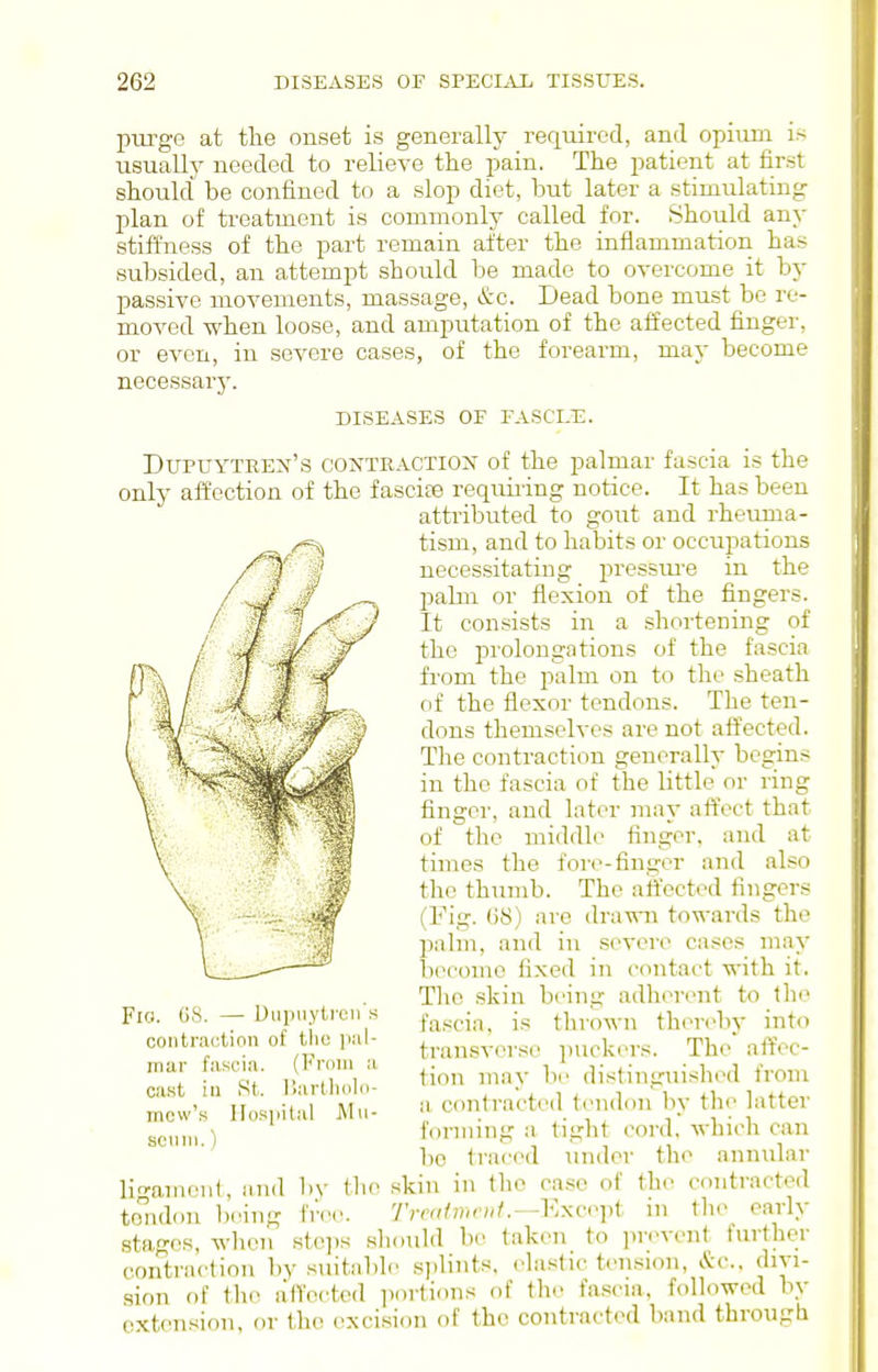 pui'ge at the onset is generally required, and opium is usuallj^ needed to relieve the pain. The patient at first should be confined to a slop diet, but later a stimulating plan of treatment is commonly called for. Should any stiffness of the part remain after the inflammation has subsided, an attempt should be made to oyercome it by passive movements, massage, &c. Dead bone must be re- moved when loose, and amputation of the affected finger, or even, in severe cases, of the forearm, may become necessary. DISEASES OF FASCI.E. Dupuyteen's contractiox of the palmar fascia is the only affection of the fasciae requiiing notice. It has been attributed to gout and rheuma- tism, and to habits or occupations necessitating pressui'e in the l^alm or flexion of the fingers. It consists in a shortening of the prolongations of the fascia from the palm on to the sheath of the flexor tendons. The ten- dons themselves are not aftected. The contraction generally begins in the fascia of the little or ring fingei', and later may affect that of the middle finger, and at times the fore-finger and also the thumb. The ah'ected fingers (Fig. (iS) arc drawn towards the palm, and in severe cases may l)ecomc fixed in contact with it. The skin being adherent to 1h(> Fig. GS. — DiiiMiytreii s tlu'own ther(>bv into contraction of the lal- ^,..^,,g,.,>,.,^„ puckin's. The affec- mar fascm. <rom a . ^^^^ iVoni cast III St. Iiartliolii- • j. i i. i i ii i n.„„ mew's Hospital AIu- m contracted tend(.n by the hitter gp„,ii formmg a tight cord, which can bo traced under the annvilar liganieiil, iiiid l)y tlie skin in the case of the contracted tondon btnng free. 7'rrai'mc»^—Except in the early stages, when stojis sliould be taken to prevent further contriu'tion by suitiibh; .splints, elastic tension, &c.. divi- sion of tlK> a'fTected portions of the fascia, followed by extension, or the excision of the contracted band through