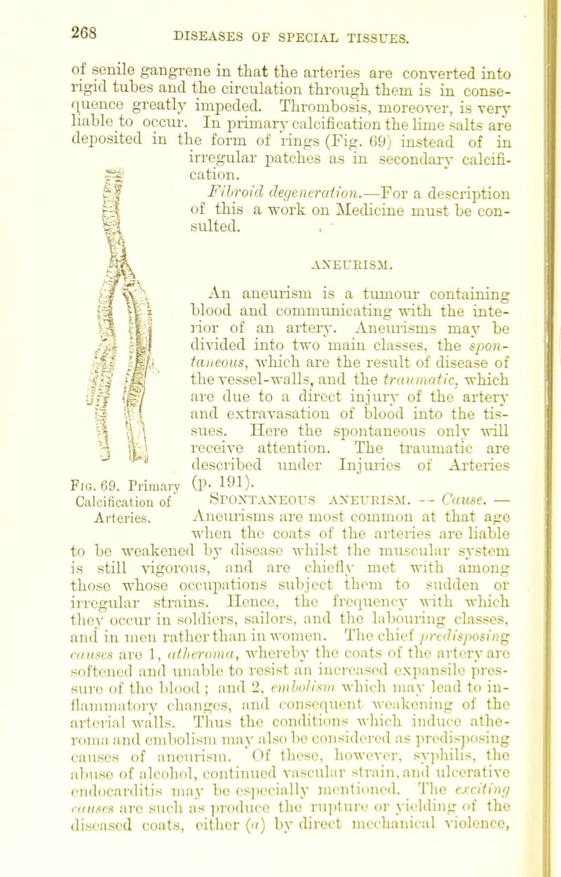 of senile gangrene in that the arteries are converted into rigid tubes and the circulation through them is in conse- quence greatly impeded. Thrombosis, moreover, is very liable to occur. In jDrimary calcification the lime salts are deiDosited in the form of rings (Fig. 69) instead of in irregular patches as in secondary' calcifi- cation. Fibroid degeneration.—For a description of this a work on Medicine must be con- sulted. AXEUEISM. An aneurism is a tumour containing blood and commimicating -with the inte- rior of an artery. Aneiuisms may be divided into two main classes, the spon- taneous, Avliich are the result of disease of the vessel-walls, and the traumatic, which Wl ^^'^ ^^^^ ^° ^ direct injury of the artery and extravasation of blood into the tis- % \\ sues. Here the spontaneous only will S iL' receive attention. The traimiatic are ^ described under Injuries of Arteries Fig. 69. Primary (P- l^'l)- Calcification of SPOXTAXEOUS ^VXEURISM. -- Cause. — Arteries. Anemisms are most common at that age when the coats of the arteries are liable to be weakened by disease whilst the muscular system is still vigorous, and are chiefly met with among those whose occupations subject them to sudden or irregular strains. Hence, the frequcncj- Avith which they occur in soldiers, sailors, and the labouring classes, and in men rather than in women. Tlie chief predisposing causes are 1, atheroma, whereby the coats of the artery are softened and unable to resist an increased expansile pres- sure of the blood ; and 2, embolism which may lead to in- flammatory changes, and consequent wenkoning of the arterial Avails. Thus the conditions which induce athe- roma iind eniboHsm may also be considered as predisjwsing causes of aneurism. Of these, however, sy])liihs, the abuse of alcohol, continued vasculnr strain, and ulcerative endocarditis may be esjiccially mentioned. The e.rcHing causes are sucli as ]-)roduce the ru]iture or yielding of the diseased coats, either (a) by direct mechanical violence,