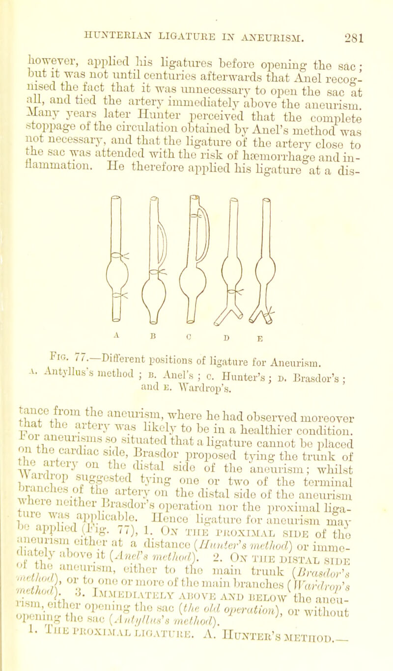 however, applied his ligatures before opening the sac • but it was not until centuries afterwards that Anel recoo-I nised the fact that it was imnecessaiy to open the sac at all, and tied the artery immediately above the aneurism -Many years later Hunter perceived that the complete stoppage of the circulation obtained by Auel's method was not necessary, and that the ligature of the artery close to the sac was attended with the risk of hcemorrhage and in- flammation. He therefore applied his Kgature at a dis- Fig. 77.—Diflerent positions of ligature for Aneurism. A. Antylluss metliod ; b. Anels ; c. Hunter's; d. Brasdor's : and E. Wardrop's. tauce from the aneurism, where he had observed moreover mat the artery was likely to be in a healthier condition, x oi aneurisms so situated that a ligature cannot be placed on the cardiac side, Brasdor proposed tying the trunk of the artery on the distal side of the aneairism; whilst VVaidrop suggested t.ying one or two of the terminal lanclies of the artery on the distal side of the aneurism A here neither Brasdor's operation nor the proximal liga- t le was applicable. Hence ligature for aneurism may b apphed _(l.ig. 77), 1. On tuk I'JtoxiMAL side of the aneurism either at a dmtanco {JInnier's method) or immo- d ately above it {Ancl's rnelhoU). 2. Ox t„e ijisTAL sTde ' tV^ or more of tlie main branches (ff arV/r./.'. Mod) .3. lArMEDiATKr.Y ABOVE ANB JiELow the auou- v.sni,_either opening tlie sac {the old ojMion), ovZ^Zt oiK'nmg the sac (.1 „/,///,,,',. ,nelhod). 1. il'l^l'UOXI.MALLIOATUUE. A. HuXTEIl's METHOD.-