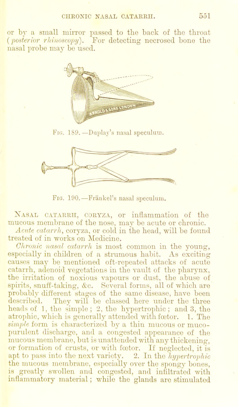 or by a small mirror passed to tlie back of the throat (posterior rlriuoscopy). For detecting necrosed bone the nasal in'obe maj' be used. Fio. 1S9. —Display's nasal sijeculum. Fig. 190.—Fraukel'.s nasal specnlani. Xasal catarrh, coryza, or inflammation of tlie mucous membrane of the nose, may be acute or chronic. Acute catarrh, corj'za, or cold in the head, vnW be found treated of in works on Medicine. Citronic nasfil cutarrh is most common in the young, especially in children of a strumous habit. As exciting causes may be mentioned oft-repeated attacks of acute catarrh, adenoid vegetations in the vault of the pharynx, the irritation of noxious vapours or dust, the abuse of spirits, snuff-taking, &c. Several forms, all of which are probably different stages of the same disease, have been described. They will be classed here under the three heads of 1, the simple; 2, the hypertrophic; and 3, the atro])hic, which is generally attended withfoetor. 1. The simjite form is characterized by a thin mucous or muco- purulent discharge, and a congested appeava,nce of the mucous mombi'uno, but is unattended with any tliickening, or formation of crusts, uv with footor. If uegloctod, it is apt to jiass into the next variety. 2. In the hypcrtrojiluc the mucous membrane, especially over the spongy bones, is greatly swollen and congested, and inhltratcd with inflammatory iriaterial; while the glands are stimulated