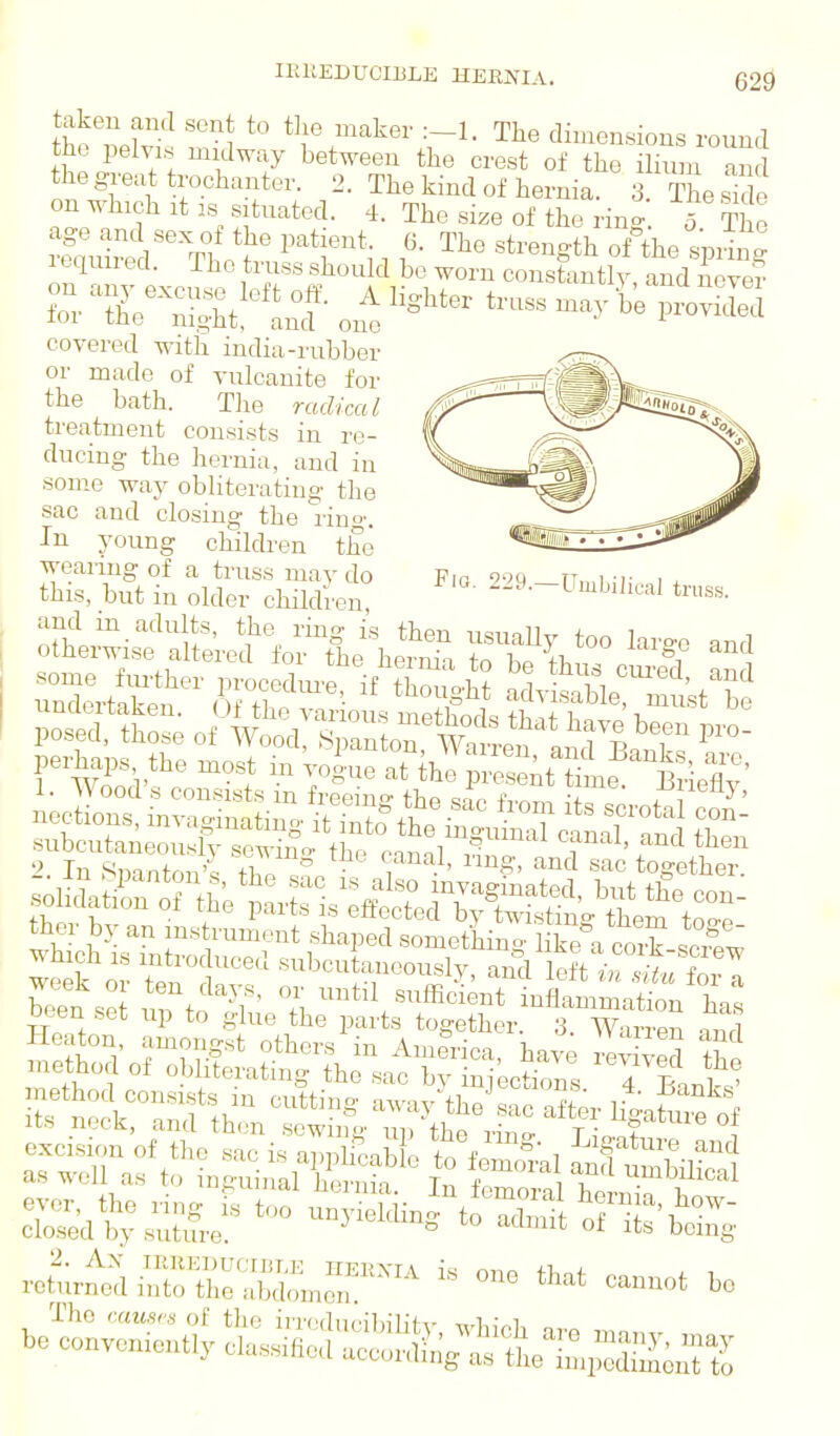 lEllEDUCIliLE HERjVIA, Flo. 229.-Umbi]ical truss. tieZw the maker The dimensions round the pelvis midway between the crest of the ilium an thegre.it trochanter. 2. The kind of hernia. 3 T esk e on which It IS situated. 4. The size of the ring 5 The lequired. The truss should bo worn constantly, and never covered with india-rubber or made of vulcanite for the bath. The radical treatment consists in re- ducing the hernia, and in some way obliterating the sac and closing the ring. In young children the wearing of a truss may do this, but in older children ther by an ms rum,:.nt shaped something like^a cox? scTw which IS introduced subcutanoously, and len in s'L7n7. ever, the ring is too unyielding tfXil of ' l  closed by suture. °^ ^ The am-sr*' of tlie irnHlucilnh'K- w1-,,V.l, „