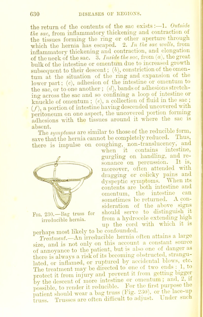 the return of th.e contents of the sac exists:—!. Oidsi'h the sac, from inflammatory thickening and contraction of the tissues forming the ring or other aperture thi'ough wliich the hernia has escaped. 2. In iJie sue tvills, from inflammatory thickening and contraction, and elongation of the ueck of the sac. 3. Inside the sac, from (a;, the great bulk of the intestine or omentum due to increased growth subsequent to their descent; (h), constriction of the omen- tum at the situation of the ring and expansion of the lower part; (c), adhesion of the intestine or omentum to the sac, or to one another ; (tZ), bands of adhesions stretch- ing across the sac and so confining a loop of intestine or knuckle of omentum ; (e), a collection of fluid in the sac ; (/), a portion of intestine having descended uncovered with peritoneum on one aspect, the imcovered portion formmg adhesions with the tissues around it where the sac is absent. -i i i. The symptoms are similar to those of the reducible form, save that the hernia cannot be completely reduced. Thus, there is impulse on coughing, non-translucency, and when it contains intestine, gm-gliug on handling, and re- sonance on percussion. It is, moreover, often attended with dragging or colicky pains and dyspeptic symptoms. When its contents are both intestine and omentum, the intestine can sometimes be rotiu-ned. A con- sideration of the above signs should serve to distingiu.sh it from a hydrocele extending high up the cord with which it is perhaps most likely to be confounded. _ Treatment.—An irreducible hernia often attains a large size, and is not only on this accoiuit a constant source of annoyance to the patient, but is also one of danger as there is'always a risk of its becoming obstructed, strangu- lated, or inflriinod, or ruptured by accidental blows, etc. Tho treatment may be directed to one ot two ends : }. to protect it from injury and prevent it from getting bigger by tho descent of more intestine or omentum; and, u possilfle, to render it reducible. Vov the hrst puiTosc the patient shoubl wear a bag truss (Fig. or the lace-up truss Trusses are often dillicnlt to ad.iust. Lnder such Fig. 230.—1kg truss for irreducible hernia.