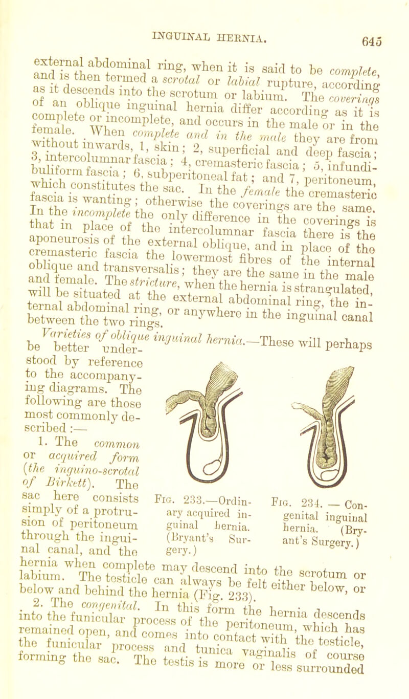 INQ-UmAL HEKNIA. and IS then termed a scrotal or labial rupture accordinD as It descends mto the scrotum or labium^ 'oS of an obhque inguinal hernia differ accordiao- as it is fe3e Zr'^^''','' ^^^ the ma e or n th^ teniale _ When complete and in the male thev are from wi hout inwards 1, skin; 2, superficial and dLp fa cL buHtSr ''^•'''^''^f^' -s^'asteric fascia ; 3!?niS: buhtorra fascia ; 6, subperitoneal fat; and 7 pentoneum cremasteric fascia the lowermost fibres he internal .and^alf ^1'/'^^T in th^ m^lt wiU be si mted n t?r''' T^''^ «^\li«™ia is strangulated, fl^nl 1 • 1 • external abdominal rin- the in- be'\£ ''--Itae wm peAap., stood by reference to the accompany- ing diagrams. The following are those most commonly de- scribed :— 1. The common or acquired form {the ingumo-scrotal of Birkctt). The sac here consists simply of a protru- sion of peritoneum through the ingui nal canal, and^'the Fig. 234. — Con- genital inguiual hernia. (Bry- ant's Surgery.) Fig. 233.—Ordin ary acquired in guinal Ijernia (I'-ryant's Sur- below and behind the hernia 7fiI 233? ^^ 2. The cnnf/enituL In this form i, • into tho funic dar process of tlV^^n descends c. The testis is more or less surrounded forming the sac