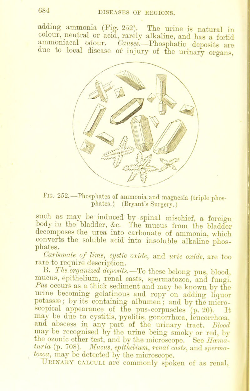 adding ammonia (Fig. 252). The urine is natural in colour, neutral or acid, rarely alkaline, and has a frx'tid ammoniacal odour. C'fufse.s.—Phosphatic deposits are due to local disease or injury of the urinary organs, Fig. 252.—Phosphates of ammonia and magnesia (triple phos- phates.) (Bryant's Surgeiy.) such as may be induced by spinal mischief, a foreign body ill the bladder, &c. The mucus from the bladd'er decomposes the urea into carbonate of ammonia, -n-hich converts the soluble acid into insoluble alkaline phos- phates. (Jarhonate_ of lime, cystic oxide, and uric oxide, are too rare to require description. B. The on/anized deposiis.—To these belong pus, blood, mucus, epithelium, renal casts, spemiatozoa, and fungi. Fus occm-s as a thick sediment and may be known by the urine becoming gelatinous and rojjy'on adding liquor potassre; by its containing albumen; and by the micro- scopical appearance of the pus-corpuscles (p. 20). It may be due to cystitis, pyelitis, gonorrhroa, Icucorrho'a. and abscess in any part^ of the urinary tract. Jlhod may be recognised by the urine being smoky or red, by the ozonic ether test, and by the microscope. ' See Hmna- turia (p. 708). Mucus, cpit/ielium, renal casts, and spernw- tozna, may bo detected by the microscope. UiUNAiiY CALCULI arc commonly spoken of as renal.