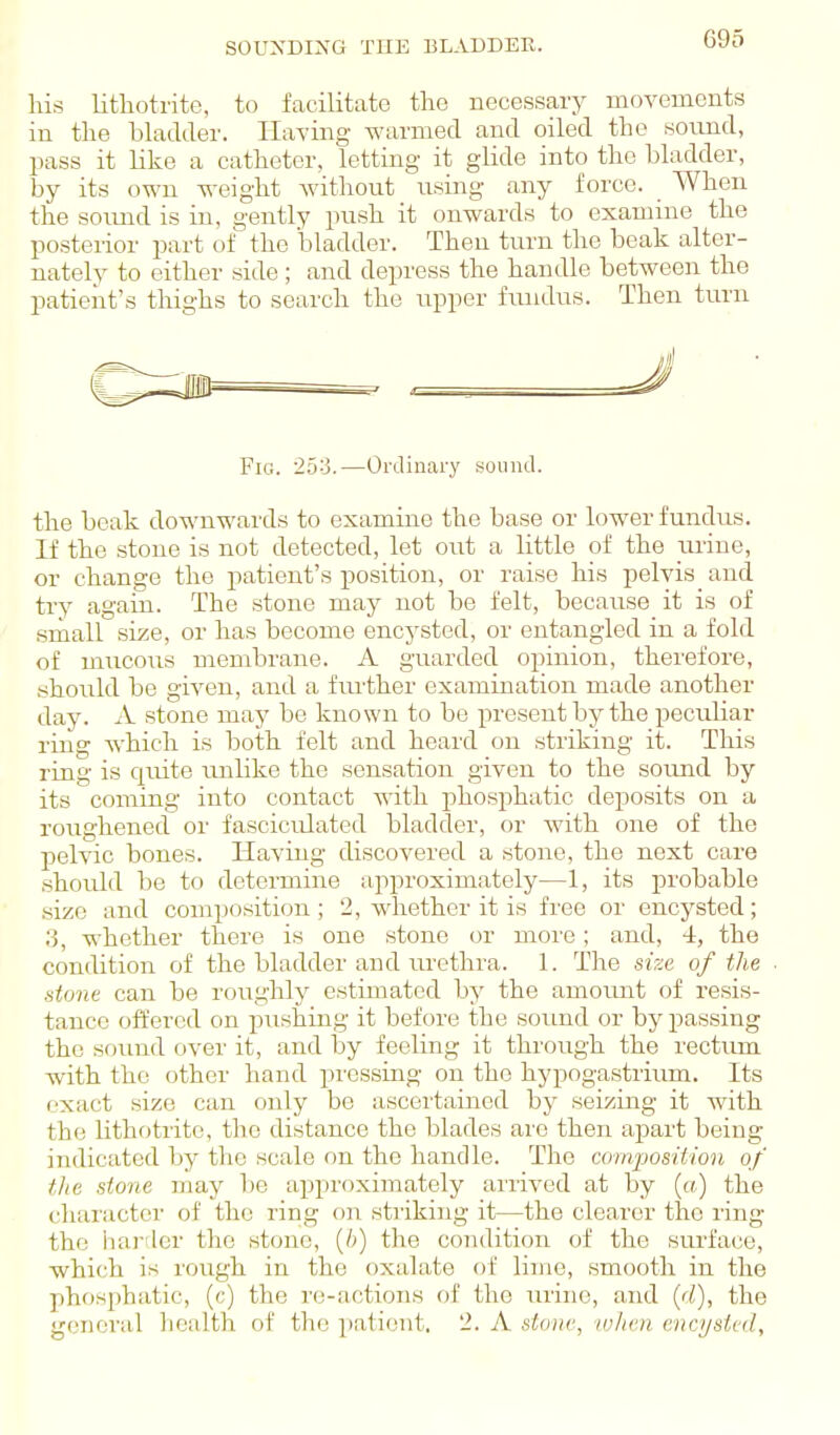 SOUNDING THE BLADDER. his lithotrite, to facilitate the necessary moA^ements in the bladder. Haying warmed and oiled the sound, pass it like a catheter, letting it glide into the bladder, by its own weight without using any force. _ When the soimd is in, gently push it onwards to examine the posterior part of the bladder. Then turn the beak alter- nately to either side ; and depress the handle between the patient's thighs to search the upper fundus. Then turn Fig. 25:3.—Ordinary sound. the beak downwards to examine the base or lower fundus. If the stone is not detected, let out a little of the _ui-ine, or change the patient's position, or raise his pelvis and try again. The stone may not be felt, because it is of srnall size, or has become encysted, or entangled in a fold of mucous membrane. A guarded opinion, therefore, .should be given, and a fiuther examination made another day. A stone may be known to be present by the peculiar riiig which is both felt and heard on striking it. This ring is quite imlike the sensation given to the sound by its coming into contact with phosphatic deposits on a roughened or fasciculated bladder, or with one of the pelvic bones. Having discovered a stone, the next care should be to determme approximately—1, its probable .size and composition; 2, whether it is free or encysted; 3, whether there is one stone or more; and, 4, the condition of the bladder and urethra. 1. The size of the stone can be roughly estimated by the amotmt of resis- tance offered on pushing it before the sound or by passing the sound over it, and by feeling it through the I'ectiun with the other hand pressing on the hypogastrium. Its exact size can only be ascertained by seizing it Avith the lithotrite, the distance the blades are then apart being indicated by the scale on the handle. The comjjosition of the stone may be approximately arrived at by (a) the character of the ring on striking it—the clearer the ring the hanler the stone, (6) the condition of the surface, which is rough in the oxalate of lime, smooth in the phosphatic, (c) the re-actions of the tu'ine, and {d), the general health of the patient, 2. A stone, wlien encysted.