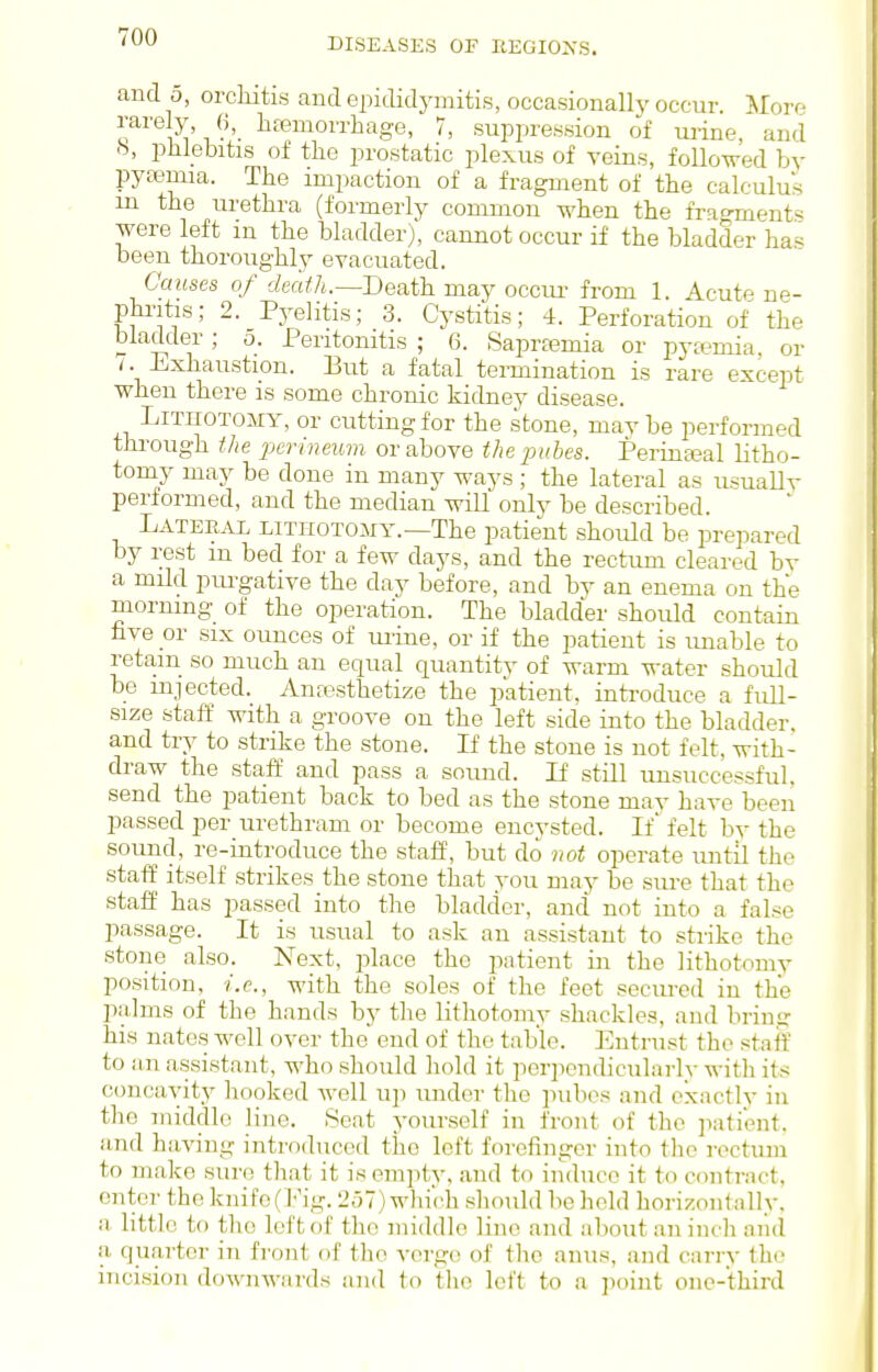 and 5, orcliitis and epididymitis, occasionally occur. ILovp rarely fi, hfemorrhage, 7, suppression of mine, and b, phlebitis of the prostatic plexus of veins, followed by pya3mia. The impaction of a fragment of the calculus m the urethra (formerly common when the fragments were left in the bladder), cannot occur if the bladder ha^ been thoroughly evacuated. Causes of death.—Death may occui- from 1. Acute ne- pbritis; 2. Pyelitis; 3. Cystitis; 4. Perforation of the bladder; o. Peritonitis ; 6. Saprjemia or pyEemia, or /. Exhaustion. But a fatal termination is rare except when there is some chronic kidney disease. Lithotomy, or cutting for the stone, mav be performed through the perineum or above the pabes. Perina?al litho- tomy may be done in many ways ; the lateral as usuallv performed, and the median will only be described. Lateral LiTnoTOixY.—The patient should be prepared by rest m bed for a few days, and the rectum cleared bv a mild purgative the day before, and bv an enema on the morning of the operation. The bladder should contain five or SIX ounces of urine, or if the patient is imable to retain so much an equal quantity of warm water should be injected. Anaesthetize the patient, inti-oduce a full- size staff with a groove on the left side into the bladder, and try to strike the stone. If the stone is not felt, with- draw the staff and pass a sound. If still unsuccessful, send the patient back to bed as the stone may have been passed per urethram or become encysted. If felt by the sound, re-introduce the staff, but do not operate until the staff itself strikes the stone that you may be sure that the staff has passed into the bladder, and not into a false passage. It is usual to ask an assistant to strike the stone also. Ng^^^ Y>^acQ the patient in the lithotomy position, i.e., with the soles of the feet secured in the palms of the hands by the lithotomy shackles, and brin<r bis nates well over the end of the table. Entrust the staff to an assistant, who should hold it por])endicularly with its concavity hooked avoU u]i under tlie pubos and exactlv in the middle lino. Seat yourself in front of the patient, and having introduced the left forefinger into the rectum to make sure that it is empty, and to induce it to contract, enter the knife (Pig. 257) which should be hold horizontally, a little to the loft of the middle line and about an inch aiid a quarter in front of the verge of tlie anus, and carry the incision downwards and to the left to a point one-third