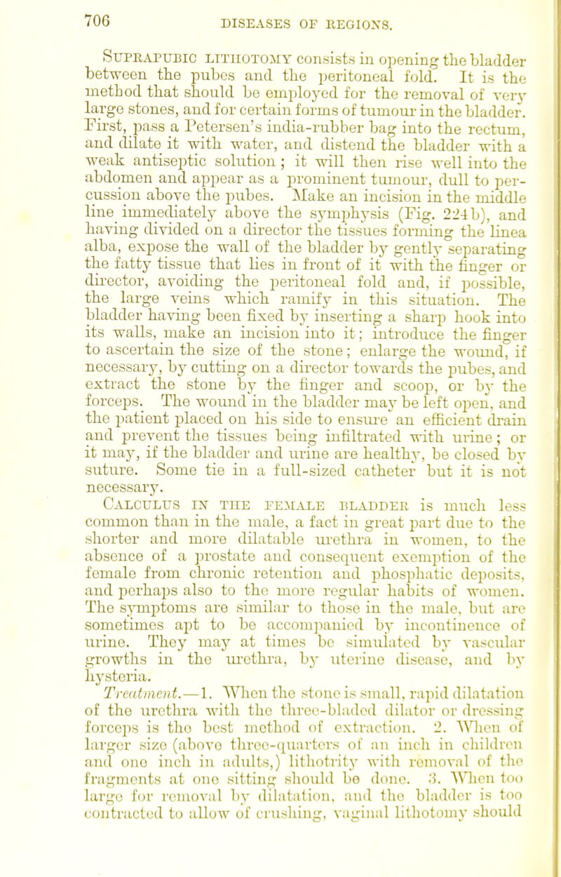 Suprapubic LiTiiOTOiiY consists in opening the bladder between the pubes and the peritoneal fold. It is the method that should be employed for the removal of very large stones, and for certain forms of tumour- in the bladder. First, pass a Petersen's india-rubber bag into the rectum, and dilate it with water, and distend the bladder with a weak antiseptic solution; it will then rise well into the abdomen and appear as a prominent tumour, dull to per- cussion above the pubes. Make an incision in the middle line immediately above the symphysis (Fig. 2:24b), and having divided on a director the tissues forming the linea alba, expose the wall of the bladder by gently separating the fatty tissue that lies in front of it with the finger or director, avoiding the peritoneal fold and, if possible, the large veins which ramify in this situation. The bladder having been fixed by inserting a sharp hook into its walls, make an incision into it; introduce the finger to ascertain the size of the stone; enlarge the wound, if necessary, by cutting on a director towards the pubes, and extract the stone by the finger and scoop, or by the forceps. The wound in the bladder may be left open, and the patient placed on his side to ensm-e an efficient di-ain and prevent the tissues being infiltrated with urine; or it may, if the bladder and mine are healthy, be closed bv suture. Some tie in a full-sized catheter but it is not necessary. Calculus ijf the pejiale bladder is much less common than in the male, a fact in great part due to the shorter and more dilatable urethra in women, to the absence of a i^rostate and consequent exemption of the female from chronic retention and phosphatic deposits, and perhaps also to the more regular habits of women. The s}Tiiptoms are similar to those in the male, but are sometimes apt to be accompanied by incontinence of urine. They may at times be siuiuiatcd by vascular growths in the urethra, by uterine disease, and by hysteria. Treatment. — 1. When the stone is snaall, rapid dilatation of the urethra with the thrce-bladed dilator or dressing forcejis is the best method of extraction. 2. A^Hicn of larger size (above three-quarters of an inch in children and one inch in adults,) lithotrity with removal of the fragments at one sitting should be done. .'3. When too largo for removal by dilatation, and the bladder is too contracted to allow of crushing, vaginal lithotomy should