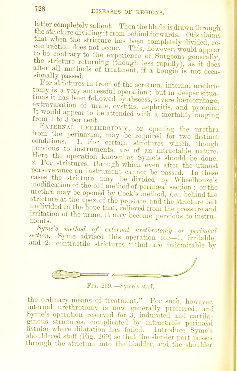 DISEASES OF EEGIOXS. latter completely salient. Then the blade is diwn through the stricture dividing it from behind forwards. Otis claims tJiat when the strictm-e has been completely divided re- contraction does not occur. This, however, would appear to be contrary to the experience of Sui-geons generallv the stricture returning (though less rapidlv), as it docs after all methods of treatment, if a bougie is not occa- sionally passed. For_strictui-es in front of the scrotum, internal urethro- tomy is a very successful operation ; but in deeper situa- tions It has been followed by abscess, severe h;emorrhac>e extravasation of urine, cystitis, nephritis, and pvten5a! Lt would appear to be attended with a mortaHtv ranoino- from 1 to 3 per cent. - ° ° External ufiETHiiOTOiiY, or opening the ui-ethi-a' from the perinreum, may be required for two distinct conditions. 1. For certain strictures which, though pervious to instruments, are of an intractable natui-e. iiere the operation known as Syme's should be done. •2. h or strictures, through which even after the utmost perseverance an instrument cannot be passed. In these cases the stricture may be divided by Wheelhouse's modifacation of the old method of perinteai section ; or the urethra may be opened by Cock's method, i.e.. behind the stricture at the apex of the prostate, and the stricture loft uudivided m the hope that, relieved from the pressure and irritation of the urine, it may become pervious to instru- ments. Syjne's method of extrrnal urethrotomy or perimml sedion.Syme advised this operation for~l, irritable, and 2, contractile strictures that are indomitable by Fni. 269.—Syiiic'.s slatl'. the ordinary moans of treatment. For such, however, internal lu-ethrotoiny is now generally iireferrcd, and Syme's operation reserved for induratoil and cartila- ginous strictures, complicated by intractable pcrina^il fistuhe where dilatation has failed. Introduce Syme's shouldered stall (Fig. 2()fl) so that the slender jiart passes through the stricture into the bladder, and the shoulder