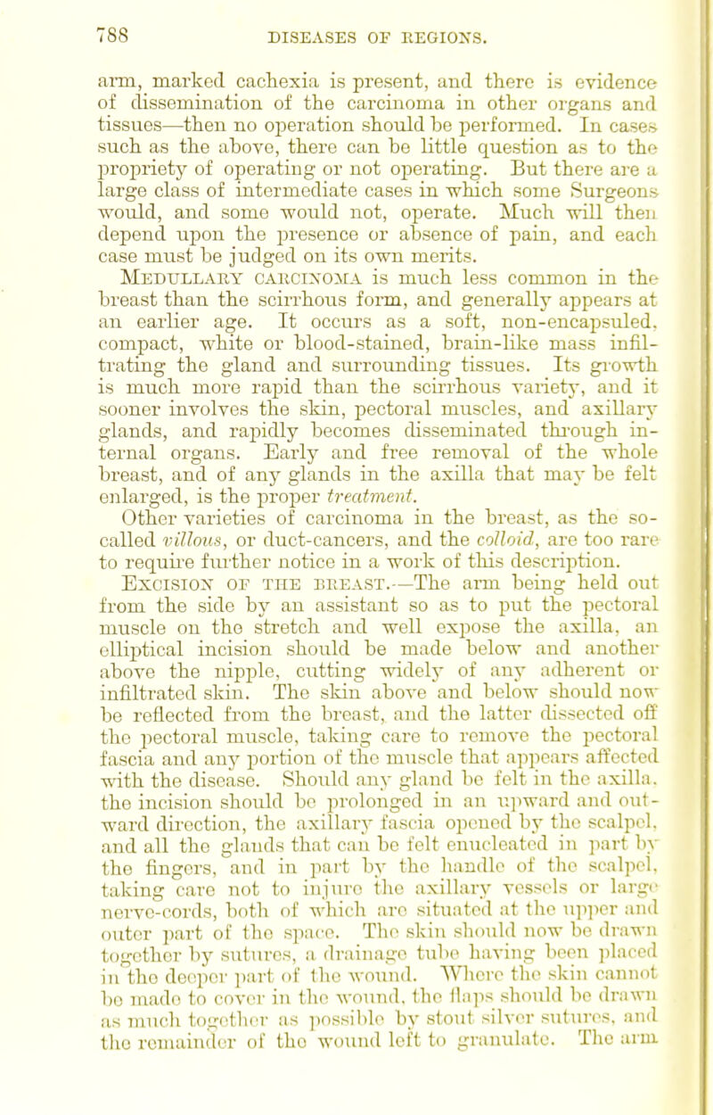 aiTa, marked cacliexia is present, and there is evidence of dissemination of the carcinoma in other organs and tissues—then no operation should be performed. In cases such as the above, there can be little question as to the propriety of operating or not operating. But there ai-e a large class of intermediate cases in which some Surgeons would, and some would not, operate. Much will then depend ui^ou the presence or absence of pain, and each case must be judged on its own merits. Medullary carcixoma is much less common in the breast than the scirrhous form, and generally appears at an earlier age. It occurs as a soft, non-encapsuled, compact, white or blood-stained, brain-like mass infil- trating the gland and surrounding tissues. Its growth is much more rapid than the scii'rhous variety, and it sooner involves the skin, pectoral muscles, and axillary glands, and rapidly becomes disseminated thi-ough in- ternal organs. Early and free removal of the whole breast, and of any glands in the axilla that may be felt enlarged, is the proper treatment. Other varieties of carcinoma in the breast, as the so- called villous, or duct-cancers, and the colloid, are too rare to requii'e fru'ther notice in a work of this description. Excisiox OE THE BREAST.—The aiTiL being held out from the side by an assistant so as to put the pectoral muscle on the stretch and well expose the axilla, an elliptical incision should be made below and another above the nipple, cutting widelj- of any adherent or infiltrated skin. The skin above and below should now be reflected from the breast, and the latter dissected oii the pectoral muscle, taking care to remove the pectoral fascia and any portion of the muscle that appears affected with the disease. Should any gland be felt in the axilla, the incision should be prolonged in an iijiward and out- ward direction, the axillary fascia opened by the scalpel, and all the glands that can be felt enucleated in part by the fingers, and in pai-t by the liandle of the scalpel, taking care not to injure the axillary vessels or large nerve-cords, both of which are situated at the u]i]icr and outer part of the space. The skin should now be drawn together by sutiu-es, a drainage tube having been placed in the deeper jiart of the wound. 'NVlicrc the skin cannot bo made to cover in the wound, the ilaps should bo drawn as much together as ])ossil)le by stout silver sutur(\'^. Jind tlic rcuuiinder of the wound loft to granulate. The arm