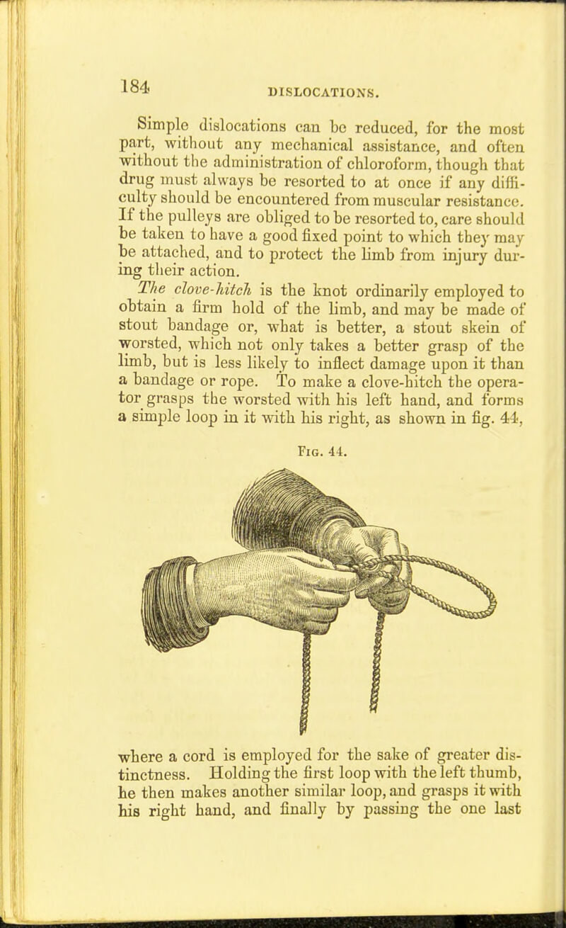 DISLOCATIONS. Simple dislocations can be reduced, for the most part, without any mechanical assistance, and often without the administration of chloroform, though that drug must always be resorted to at once if any difii- culty should be encountered from muscular resistance. If the pulleys are obliged to be resorted to, care should be taken to have a good fixed point to which they may be attached, and to protect the limb from injury dur- ing their action. The clove-liitch is the knot ordinarily employed to obtain a firm hold of the limb, and may be made of stout bandage or, what is better, a stout skein of worsted, which not only takes a better grasp of the limb, but is less likely to inflect damage upon it than a bandage or rope. To make a clove-hitch the opera- tor grasps the worsted with his left hand, and forms a simple loop in it with his right, as shown in fig. 44, Fig. 44. where a cord is employed for the sake of greater dis- tinctness. Holding the first loop with the left thumb, he then makes another similar loop, and grasps it with his right hand, and finally by passing the one last