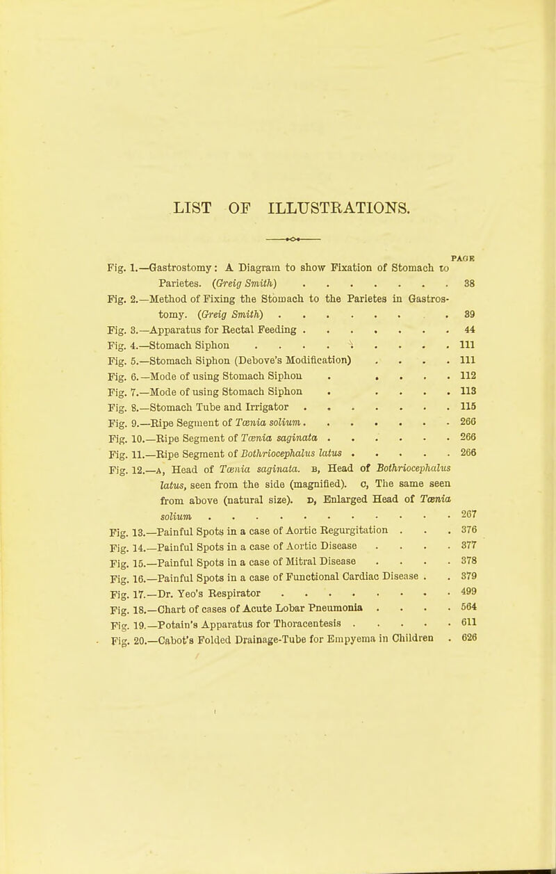 LIST OF ILLUSTRATIONS. PAGE Fig. 1.—Gastrostomy: A Diagram to show Fixation of Stomach to Parietes. (Greig Smith) 38 Fig. 2.—Method of Fixing the Stomach to the Parietes in Gastros- tomy. {Greig Smith) .39 Fig. 3.—Apparatus for Kectal Feeding 44 Fig. 4.—Stomach Siphon . . . . s. . . .111 Fig. 5.—Stomach Siphon (Debove's Modification) . . . .111 Fig. 6. —Mode of using Stomach Siphon . .... 112 Fig. 7.—Mode of using Stomach Siphon . .... 113 Fig. 8.—Stomach Tube and Irrigator 115 Fig. 9.—Ripe Segment of Tcenia solium 266 Fig. 10.—Ripe Segment of Tcenia saginata ...... 266 Fig. 11.—Ripe Segment of Bothriocephalus latus 266 Fig. 12.—a, Head of Tcenia saginata. b, Head of Bothriocephalus latus, seen from the side (magnified), o, The same seen from above (natural size), d, Enlarged Head of Tcenia solium 267 Fig. 13.—Painful Spots in a case of Aortic Regurgitation . . .376 Fig. 14.—Painful Spots in a case of Aortic Disease .... 377 Fig. 15.—Painful Spots in a case of Mitral Disease .... 378 Fig. 16.—Painful Spots in a case of Functional Cardiac Disease . . 379 Fig. 17.—Dr. Yeo's Respirator 499 Fig. 18.—Chart of cases of Acute Lobar Pneumonia . . . .564 Fig. 19.—Potain's Apparatus for Thoracentesis 611 Fig. 20.—Cabot's Folded Drainage-Tube for Empyema in Children . 626