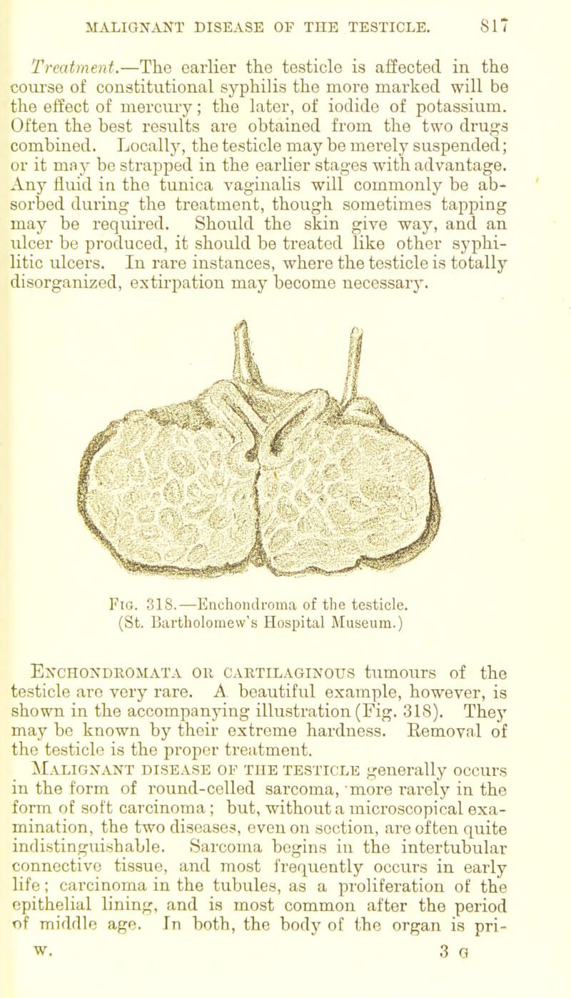 Treatment.—The earlier the testicle is afiected in the coiirse of constitutional syphilis the more marked will be the effect of mercury; the later, of iodide of potassium. Often the best results are obtained from the two drugs combined. Locally, the testicle may be merely suspended; or it may be strapped in the earlier stages with advantage. Any fluid in the tunica vaginalis will commonly be ab- sorlaed during the treatment, though sometimes tapping may be required. Should the skin give way, and an ulcer be produced, it should be treated like other syphi- litic ulcers. In rare instances, where the testicle is totally disorganized, extirpation may become necessarj'. Fig. 318.—Enchondroma of the testicle. (St. Bartholomew's Hospital Museum.) EXCHOXDROMATA Oil CAETILAGINOUS tumours of the testicle are very rare. A. beautiful example, however, is shown in the accompanying illustration (Fig. 318). The}' may be known by their extreme hardness. Removal of the testicle is the proper treatment. Maligxant DISEASE OF THE TESTICLE generally occurs in the form of round-celled sarcoma, more rarely in the form of soft carcinoma; but, withou.t a microscopical exa- mination, the two diseases, even on section, are often quite indistinguishable. Sarcoma begins in the intertubular connective tissue, and most frequently occurs in early life; carcinoma in the tubules, as a proliferation of the epithelial lining, and is most common after the period of middle age. In both, the body of the organ is pri- w. 3 G