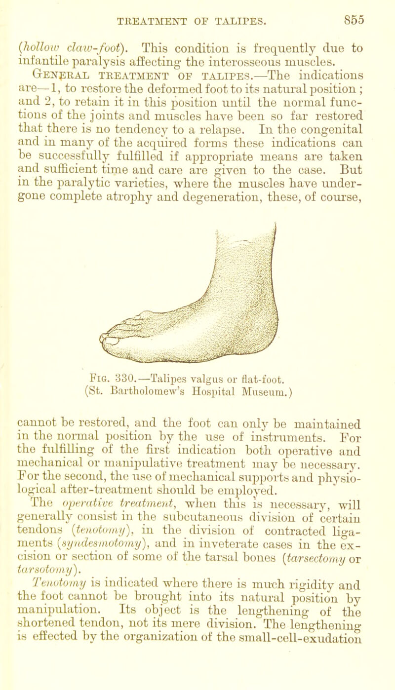 (hollow daw-foot). This condition is frequently due to infantile paralysis affecting the interosseous muscles. General treatment of t.^UjIpes.—The indications iii'e— 1, to restore the deformed foot to its natural position; and 2, to retain it in this position until the normal func- tions of the joints and muscles have been so far restored that there is no tendency to a relapse. In the congenital and in many of the acquired forms these indications can be successfully fulfilled if appropriate means are taken and sufBcient time and care are given to the case. But in the paralytic varieties, where the muscles have under- gone complete atrophy and degeneration, these, of coui-se, m- - - / Fig. 330.—Talipes valgus or flat-foot. (St. Bartholomew's Hospital Museum.) cannot be restored, and the foot can only be maintained in the noi-mal position by the use of instruments. For the fulfilling of the first indication both operative and mechanical or manipulative treatment may be necessaiy. For the second, the use of mechanical supports and physio- logical after-treatment should be employed. The oijcrativc treatment, when this is necessaiy, will generally consist in the subcutaneous division of certain tendons {tenotomy), in the division of contracted liga- ments {fsyiidesmotomy), and in inveterate cases in the ex- cision or section of some of the tarsal bones [tarsedomy or tarsotomy). Tenotomy is indicated where there is much rigidity and the foot cannot be brought into its natural position by manipuhition. Its object is the lengthening of the shortened tendon, not its mere division. The lengtheniuo- is effected by the organization of the small-ceU-exudatiou