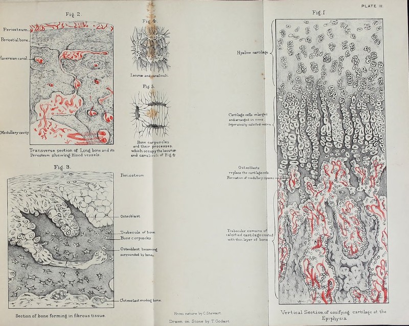 Periosteum teriostialbone- ^■ laversian ca nal Medullary cavity m Lacuns and canat'culi. Fi«.5. Tratisverse section of Lon^ bone and its Penos^m pTiewin^ Blood vessels. Bcfne corpuscles and their processes. wKioK occupy tVelacunsR and canjibculi of 'Fi^-'l' Periosteum .Trabecula ofbone. .Borie corpuscles Osteoblast becotnin^ surrounded by bonci Osteoclast eroding borie. Hyaline cartila^ Cartilage cells enlarg^' aiid arran^eiJ in rows Seperatedby calcifred nnttrivi ^ Osteotlasts Tpplace the cai-tiUgece Forrtation rf medullary S' >acei - g <t % t <^ ■ Trabecular remains of calcified cartila^eco; with tWi layer o£ boni Section of bone forming in fibrous tissue. Froni nature by C.Stewart. Drawn on Stone by T. Godart; Vertical Sectionof ossi-fying carbikfge at tVie EpipKysis.
