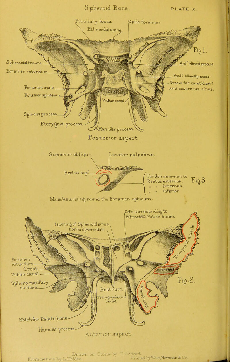 iSpKenoidl Bone PLATE X Pitvii-tarj fossa Optic foramen Etlrrnoidal spine. X. 5pHenoiclal fissuTe lorame n -potundiutTi Toramen ovale Poranien spin&sum Spinous pro cess. Pterygoid '^roaesz^y^'^^jj amubr process. Posterior aspect An clinoid process. Postr clinoiflfvocess. Groove for carotid art'' and cavernous sinus. Superior oblique. Levator palpebras. \ J. Kectus sup I Tenalon coTn-mon to ^ ^ J Beetus extemus . El^.e>. \ „ internus. I „ « inferior MiuSclesarisirig round tineToramen opticum. iJells correspnclin^'to EthmoiaSc Palate ' Foramen Crept surfac' NotcVifor Palate bone ife.Tnukr process ATiterior aspect, Dravjn on Stci ; FromnBture by L.Hclden. Prratdi by Weat.Nowruon &. Co.