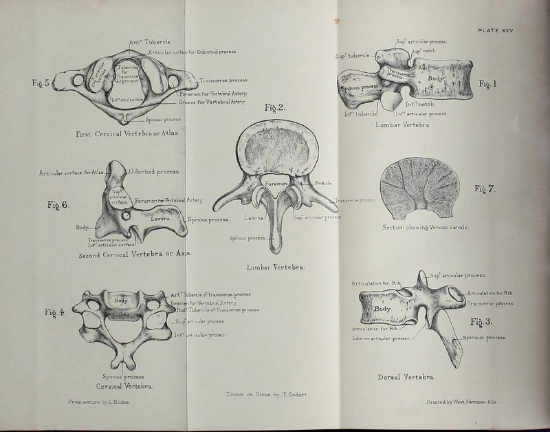 PLATE XXV. Sup^ tubercle ,Sup^ articular process Sup^ notch. Infarticulj'- surRace Second Cervical Vertebra or Ax proc( Cervical Vertebra- From nature by L-HoLdtn. ^ BoAy; '-firm ^ , Inf!'-notch. inf''tubercW llnF' articular process Lumbar Vertebra. Fig.?, Section showing Venous canals. Lumbar Yertebra. If Articulation for Rib, S\jp' articular process jbercle of transverse proces?. for VerteW Artery Tubercle of Uransverse proccds. arri._ular process, (i-vicular-orocess Articulation ForRib- 1 ransverae process Articulation for Klb- InEerioc a.rti<;ular proces: Drawn on Stone by T. Godart Dorsal Vertebra. Prmtedby'West,Newman ScCo.