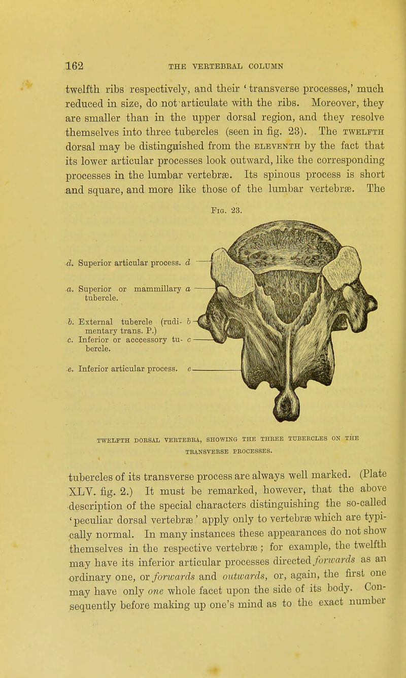 twelfth ribs respectively, and their ' transverse processes,' much reduced in size, do not articulate with the ribs. Moreover, they are smaller than in the upper dorsal region, and they resolve themselves into three tubercles (seen in fig. 23). The twelfth dorsal may be distinguished from the eleventh by the fact that its lower articular processes look outward, like the corresponding processes in the lumbar vertebrae. Its spinous process is short .and square, and more like those of the lumbar vertebrse. The Fig. 23. d. Superior articular process, d a. Superior or mammillary a tubercle. 6. External tubercle (rudi- 6 mentary trans. P.) c. Inferior or acccessory tu- c bercle. ■6. Inferior articular process, e TWELFTH DOESAL VEBTEBEA, SHOWING THE THREE TUBERCLES ON TIIE TRANSVERSE PROCESSES. tubercles of its transverse process are always well marked. (Plate XLV. fig. 2.) It must be remarked, however, that the above ■description of the special characters distinguishing the so-called 'peculiar dorsal vertebrae ' apply only to vertebra3 which are typi- cally normal. In many instances these appearances do not show themselves in the respective vertebras; for example, the twelfth may have its inferior articular processes directed/ontJards as an ordinary one, ox forwards and outwards, or, again, the first one may have only one whole facet upon the side of its body. Con- sequently before making up one's mind as to the exact number