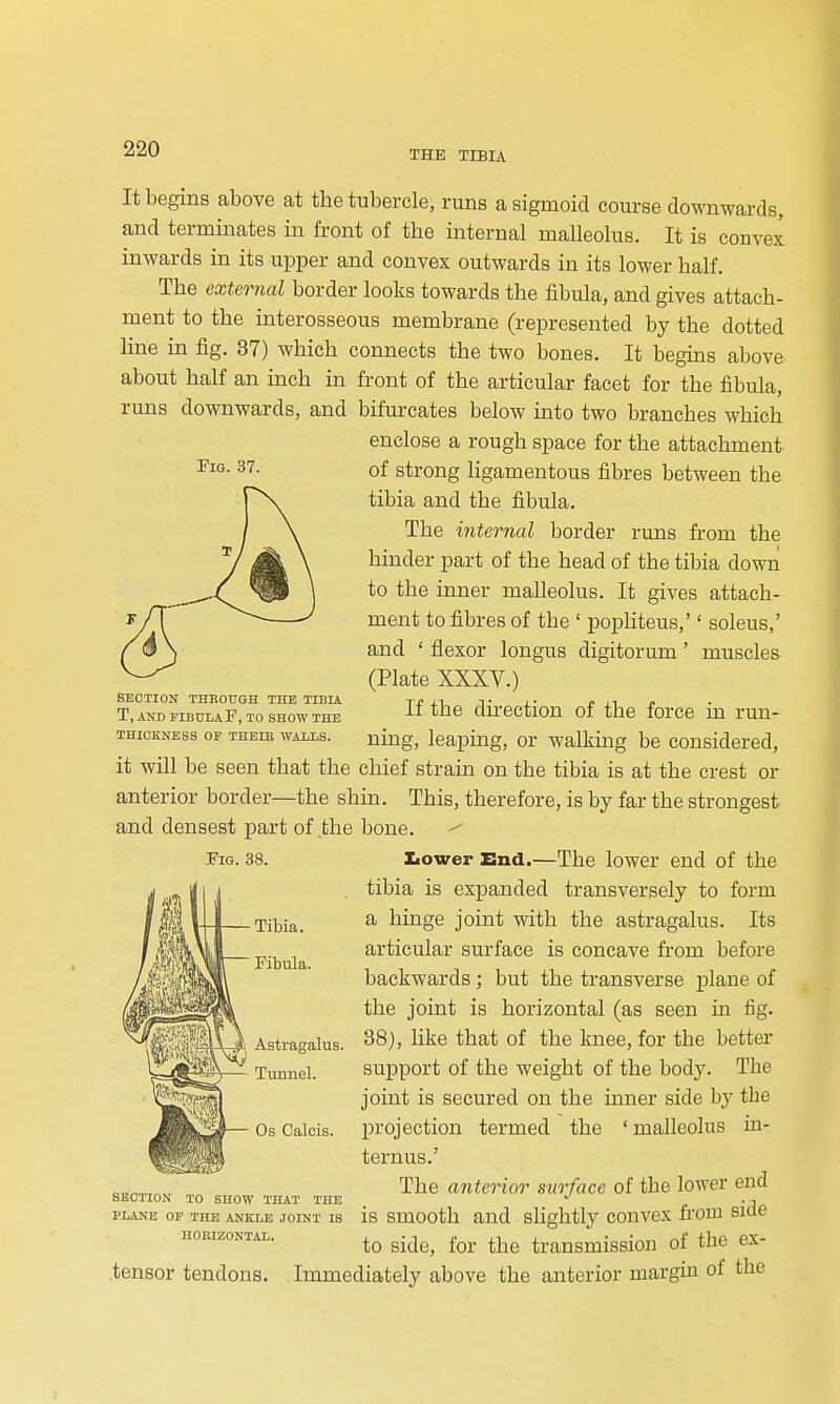 Fig. 37. It begins above at the tubercle, runs a sigmoid course downwards, and terminates in front of the internal malleolus. It is convex inwards in its upper and convex outwards in its lower half. The external border looks towards the fibula, and gives attach- ment to the interosseous membrane (represented by the dotted line in fig. 37) which connects the two bones. It begins above about half an inch in front of the articular facet for the fibula, runs downwards, and bifurcates below into two branches which enclose a rough space for the attachment of strong ligamentous fibres between the tibia and the fibula. The internal border runs from the hinder part of the head of the tibia down to the inner malleolus. It gives attach- ment to fibres of the ' popliteus,'' soleus,' and ' flexor longus digitorum' muscles (Plate XXXV.) If the direction of the force in run- ning, leaping, or walking be considered, it will be seen that the chief strain on the tibia is at the crest or anterior border—the shin. This, therefore, is by far the strongest and densest part of .the bone. Iiower End.—The lower end of the tibia is expanded transversely to form a hinge joint with the astragalus. Its articular surface is concave from before backwards ; but the transverse plane of the joint is horizontal (as seen m fig. 38), like that of the knee, for the better support of the weight of the hodj. The joint is secured on the mner side by the projection termed the ' malleolus ui- ternus.' The anterior surface of the lower end is smooth and slightly convex fi'om side SECTION THROUGH THE TIBIA T, AND FIBULA F, TO SHOW THE THICKNESS OP THEIR WALLS. Fig. 38. Astragalus. Tunnel. Os Calcis. SECTION TO SHOW THAT THE PLANE OP THE ANKLE JOINT IS HORIZONTAL. tensor tendons. to side, for the transmission of the ex Immediately above the anterior margin of the