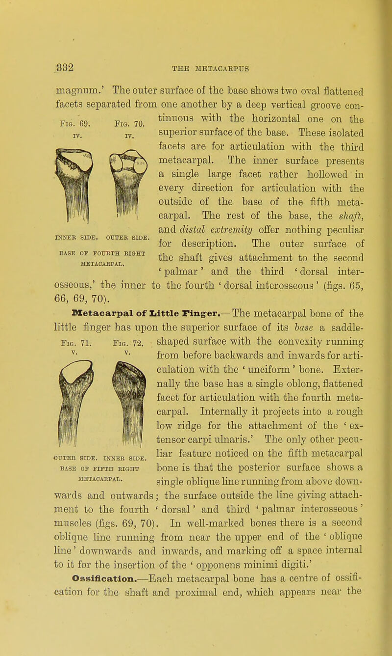 Fig. 69. IV. INNEE SIDE. OTITEB SIDE. BASE OP FOUBTH EIGHT METACABPAIi. The outer surface of the base shows two oval flattened facets separated from one another by a deep vertical groove con- tmuous with the horizontal one on the superior surface of the base. These isolated facets are for articulation with the third metacarpal. The inner surface presents a single large facet rather hollowed m every direction for articulation with the outside of the base of the fifth meta- carpal. The rest of the base, the shaft, and distal extremity offer nothing pecuHar for description. The outer surface of the shaft gives attachment to the second ' palmar ' and the third ' dorsal inter- osseous,' the inner to the fourth ' dorsal interosseous ' (figs. 65, €6, 69, 70). Metacarpal of Iiittle Ping-er.— The metacarpal bone of the little finger has upon the superior surface of its hase a saddle- shaped surface with the convexity running from before backwards and inwards for arti- culation with the * unciform ' bone. Exter- nally the base has a single oblong, flattened facet for articulation with the fourth meta- carpal. Internally it projects into a rough low ridge for the attachment of the ' ex- tensor carpi uhiaris.' The only other pecu- liar feature noticed on the fifth metacarpal bone is that the posterior surface shows a smgle oblique line runnmg from above down- wards and outwards; the surface outside the line givmg attach- ment to the fourth ' dorsal' and third ' palmar mterosseous' muscles (figs. 69, 70). In well-marked bones there is a second oblique line running from near the upper end of the ' obhque line' downwards and inwards, and marking off a space internal to it for the insertion of the ' opponens minimi digiti.' Ossification.—Each metacarpal bone has a centre of ossifi- cation for the shaft and proximal end, which appears near the ODTEE SIDE. INNEB SIDE, BASE OP FIFTH EIGHT METACABPAL.