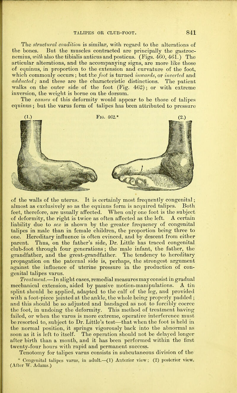 The structural condition is similar, with regard to the alterations of the bones. But the muscles contracted are principally the gastroc- nemius, with also the tibialis anticus and posticus. (Figs. 460, 461.) The articular alterations, and the accompanying signs, are more like those of equinus, in proportion to the extension and curvature of the foot, which commonly occurs ; but the foot is turned inwards, or inverted and adducted; and these are the characteristic distinctions. The patient walks on the outer side of the foot (Fig. 462); or with extreme inversion, the weight is borne on the dorsum. The causes of this deformity would appear to be those of talipes equinus ; but the varus form of talipes has been attributed to pressure (1.) Fig. 462.* (2.) of the walls of the uterus. It is certainly most frequently congenital; almost as exclusively so as the equinus form is acquired talipes. Both feet, therefore, are usually affected. When only one foot is the subject of deformity, the right is twice as often affected as the left. A certain liability due to sex is shown by the greater frequency of congenital talipes in male than in female children, the proportion being three to one. Hereditary influence is often evinced, and by descent from either parent. Thus, on the father's side, Dr. Little has traced congenital club-foot through four generations ; the male infant, the father, the grandfather, and the great-grandfather. Ihe tendency to hereditary propagation on the paternal side is, perhaps, the strongest argument against the influence of uterine pressure in the production of con- genital talipes varus. Treatment.—In slight cases, remedial measures may consist in gradual mechanical extension, aided by passive motion-manipulations. A tin splint should be applied, adapted to the calf of the leg, and provided with a foot-piece jointed at the ankle, the whole being properly padded ; and this should be so adjusted and bandaged as not to forcibly coerce the foot, in undoing the deformity. This method of treatment having failed, or when the varus is more extreme, operative interference must be resorted to, subject to Dr. Little's test—that when the foot is held in the normal position, it springs vigorously back into the abnormal as soon as it is left to itself. The operation should not be delayed longer after birth than a month, and it has been performed within the first twenty-four hours with rapid and permanent success. Tenotomy for talipes varus consists in subcutaneous division of the * Congenital talipes varus, in adult.—(1) Anterior view; (2) posterior view. (After W. Adams.)