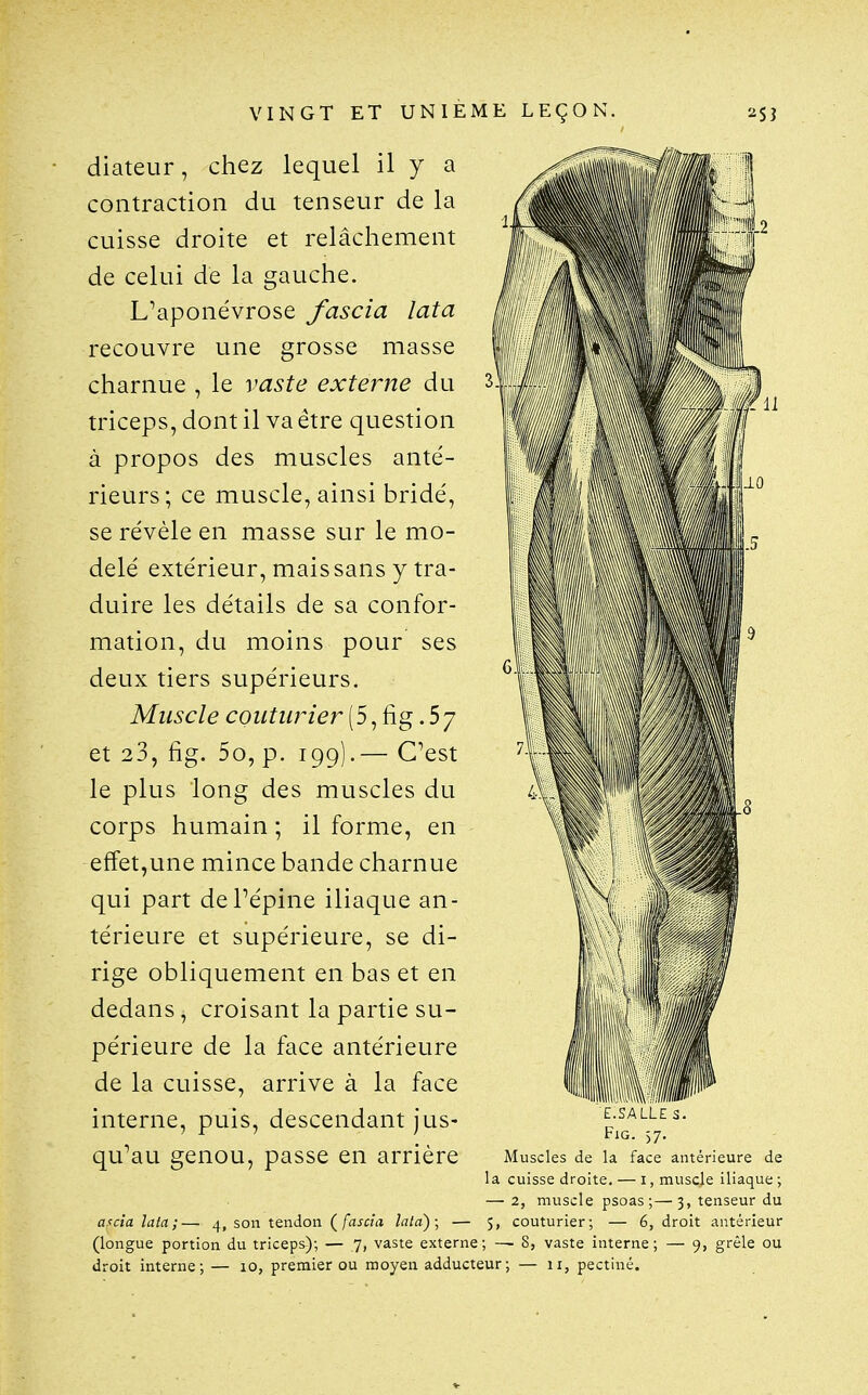 diateur, chez lequel il y a contraction du tenseur de la cuisse droite et relâchement de celui de la gauche. L^aponévrose fascia lata recouvre une grosse masse charnue , le vaste externe du triceps, dont il va être question à propos des muscles anté- rieurs; ce muscle, ainsi bridé, se révèle en masse sur le mo- delé extérieur, mais sans y tra- duire les détails de sa confor- mation, du moins pour ses deux tiers supérieurs. Muscle couturier (5, fig. 5 7 et 23, fig. 5o, p. 199).— C^est le plus long des muscles du corps humain ; il forme, en effet,une mince bande charnue qui part dePépine iliaque an- térieure et supérieure, se di- rige obliquement en bas et en dedans, croisant la partie su- périeure de la face antérieure de la cuisse, arrive à la face interne, puis, descendant jus- qu'au genou, passe en arrière a.<cia lata;— 4, son tendon (^fascia. lata); — (longue portion du triceps); — 7, vaste externe; — droit interne; — 10, premier ou moyen adducteur; I E.SALLE S. FiG. 57. Muscles de la face antérieure de la cuisse droite. — i, muscle iliaque ; — 2, muscle psoas ;— 3, tenseur du 5, couturier; — 6, droit antérieur vaste interne; — 9, grêle ou 11, pectiné.