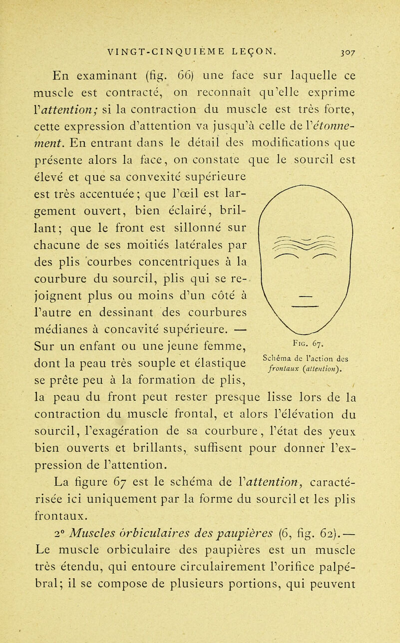 En examinant (fig. 66) une face sur laquelle ce muscle est contracté, on reconnaît qu^elle exprime Vattention; si la contraction du muscle est très forte, cette expression d^attention va jusqu^à celle de Vétonne- ment. En entrant dans le détail des modifications que présente alors la face, on constate que le sourcil est élevé et que sa convexité supérieure est très accentuée ; que Toeil est lar- gement ouvert, bien éclairé, bril- lant; que le front est sillonné sur chacune de ses moitiés latérales par des plis courbes concentriques à la courbure du sourcil, plis qui se re- joignent plus ou moins d^m côté à Fautre en dessinant des courbures médianes à concavité supérieure. — Sur un enfant ou une jeune femme, dont la peau très souple et élastique se prête peu à la formation de plis, la peau du front peut rester presque lisse lors de la contraction du muscle frontal, et alors Télévation du sourcil, l'exagération de sa courbure, Tétat des yeux, bien ouverts et brillants, suffisent pour donner Pex- pression de Pattention. La figure 67 est le schéma de Vattention, caracté- risée ici uniquement par la forme du sourcil et les plis frontaux. 2° Muscles orbiciilaires des paupières (6, fig. 62).— Le muscle orbiculaire des paupières est un muscle très étendu, qui entoure circulairement l'orifice palpé- bral; il se compose de plusieurs portions, qui peuvent Fig. 67, Schéma de raction des frontaux (attention).