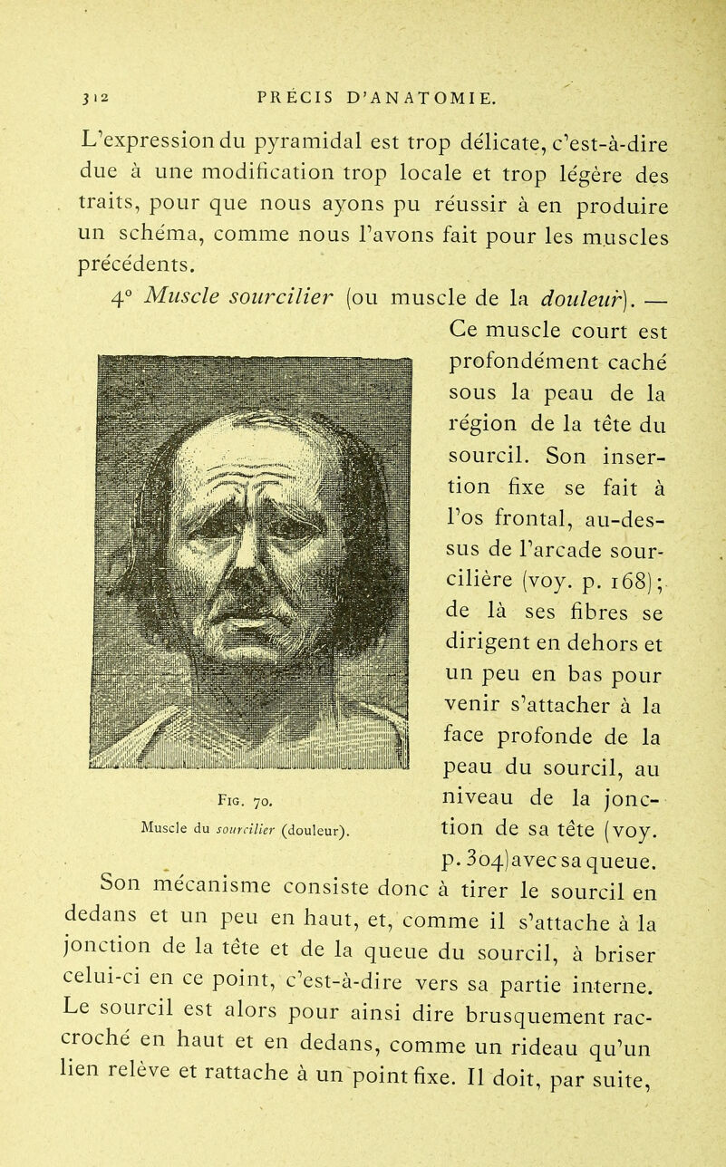 L^expression du pyramidal est trop délicate, c^est-à-dire due à une modification trop locale et trop légère des traits, pour que nous ayons pu réussir à en produire un schéma, comme nous Tavons fait pour les muscles précédents. 4° Muscle sourcilier (ou muscle de la douleur). — Ce muscle court est profondément caché sous la peau de la région de la tête du sourcil. Son inser- tion fixe se fait à Tos frontal, au-des- sus de Tarcade sour- cilière (voy. p. i68) ;. de là ses fibres se dirigent en dehors et un peu en bas pour venir s'attacher à la face profonde de la peau du sourcil, au niveau de la jonc- tion de sa tête (voy. p. 3o4)avec sa queue. Son mécanisme consiste donc à tirer le sourcil en dedans et un peu en haut, et, comme il s'attache à la jonction de la tête et de la queue du sourcil, à briser celui-ci en ce point, c'est-à-dire vers sa partie interne. Le sourcil est alors pour ainsi dire brusquement rac- croché en haut et en dedans, comme un rideau qu'un lien relève et rattache à un point fixe. Il doit, par suite, FiG. 70, Muscle du sourcilier (douleur).