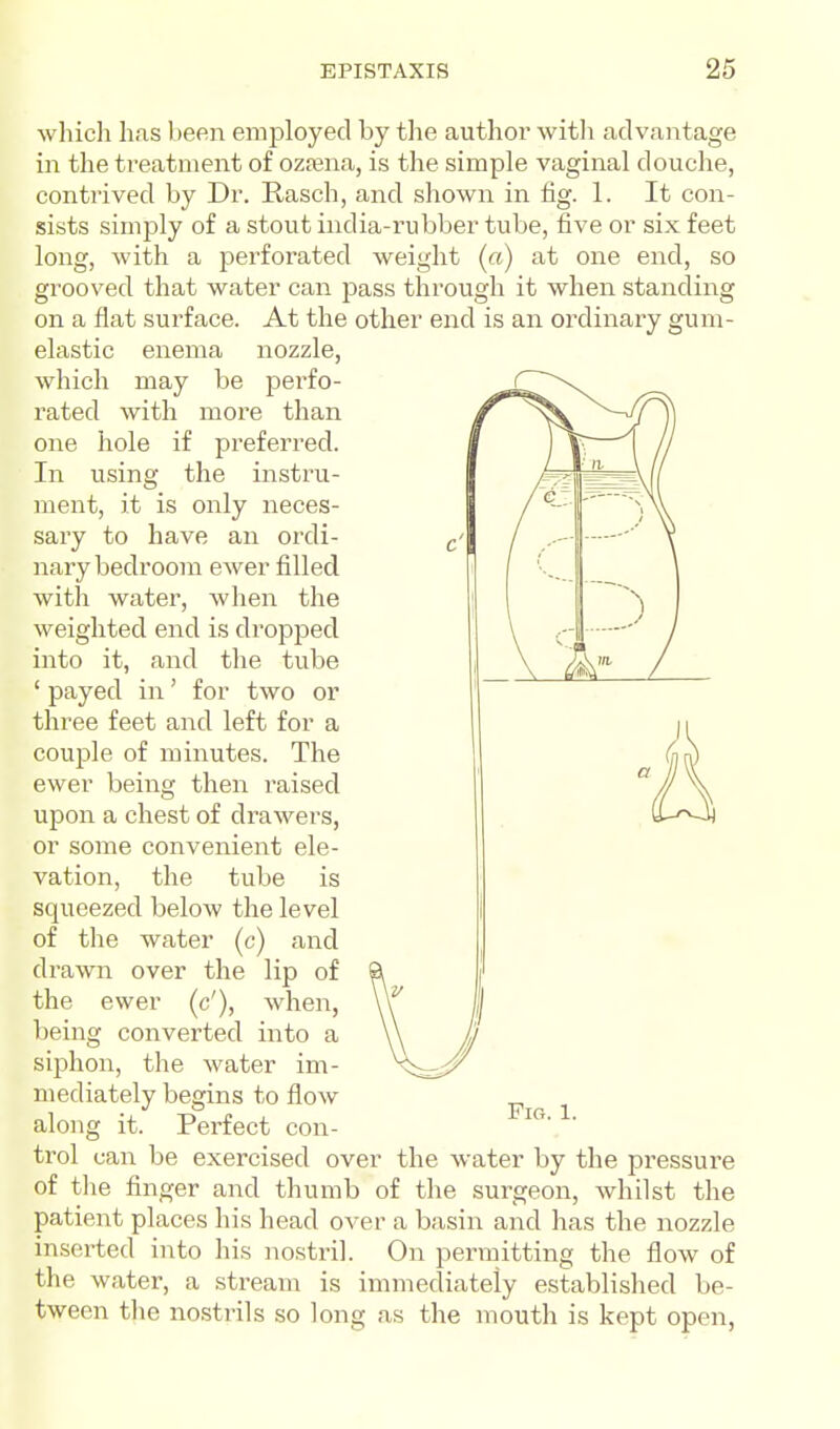 which has been emjaloyed by tlie author witli advantage in the treatment of ozfena, is the simple vaginal douche, contrived by Dr. Rasch, and shown in tig. 1. It con- sists simply of a stout india-rubber tube, five or six feet long, with a perforated weight {a) at one end, so grooved that water can pass through it when standing on a flat surface. At the other end is an ordinary gum- elastic enema nozzle, which may be perfo- rated with more than one hole if preferred. In using the instru- ment, it is only neces- sary to have an ordi- nary bedroom ewer filled with water, when the weighted end is dropped into it, and the tube ' payed in' for two or three feet and left for a couple of minutes. The ewer being then raised upon a chest of drawers, or some convenient ele- vation, the tube is squeezed below the level of the water (c) and drawn over the lip of the ewer (c'), when, being converted into a siphon, the water im- mediately begins to flow along it. Perfect con- trol can be exercised over the water by the pressure of tlie finger and thumb of the surgeon, whilst the patient places his head over a basin and has the nozzle inserted into his nostril. On permitting the flow of the water, a stream is immediately established be- tween the nostrils so long as the mouth is kept open,