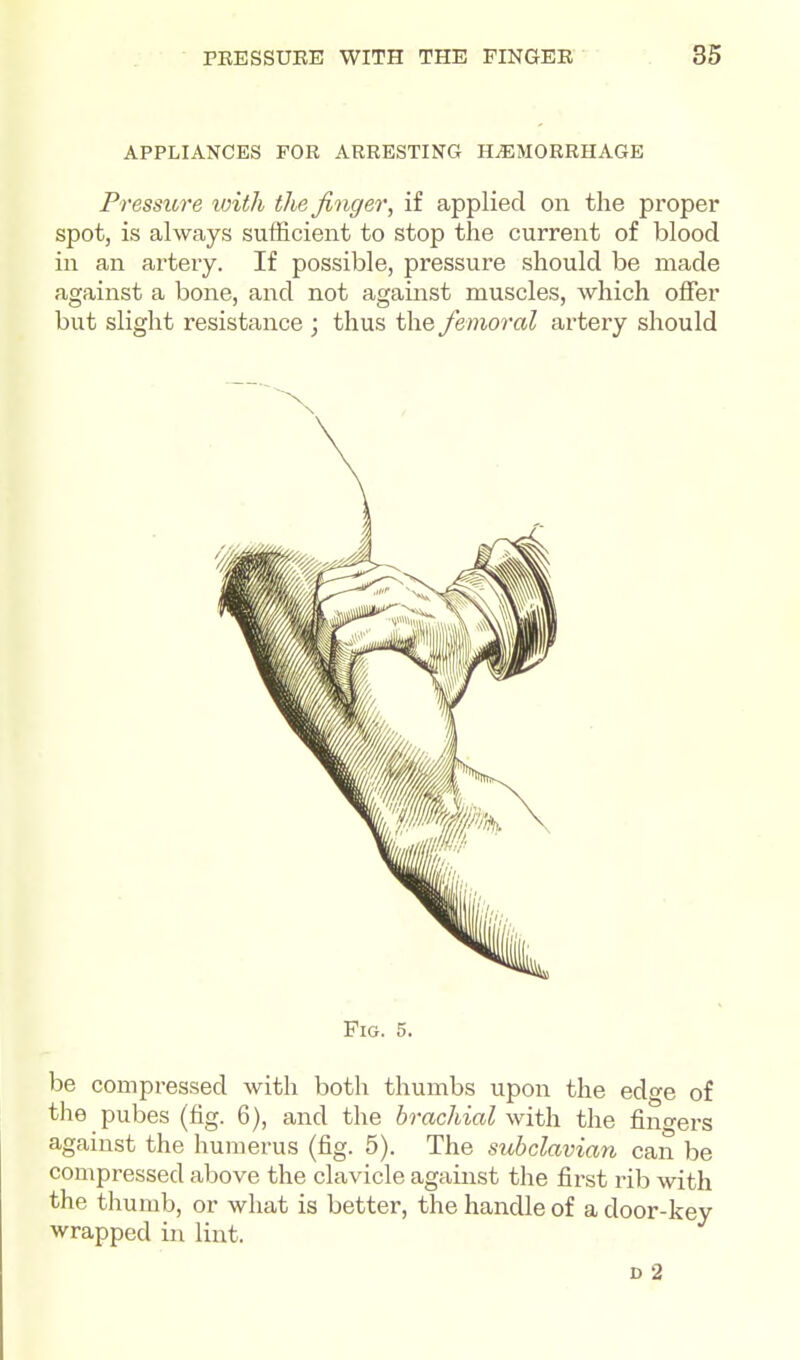 APPLIANCES FOR ARRESTING HEMORRHAGE Pressitre loith the finger, if applied on the proper spot, is always sufficient to stop the current of blood in an artery. If possible, pressure should be made against a bone, and not against muscles, which offer but slight resistance ; thus the femoral artery should Fig. 5. be compressed with both thumbs upon the edge of the pubes (fig. 6), and the brachial with the fino-ers against the humerus (fig. 5). The subclavian can be compressed above the clavicle against the first rib with the thumb, or what is better, the handle of a door-key wrapped in lint. D 2