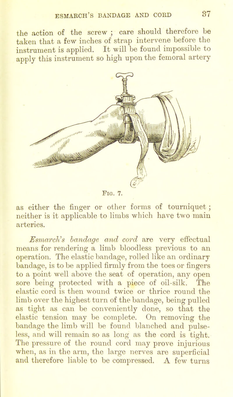 the action of the screw ; care should therefore be taken that a few inches of strap intervene before the instrument is applied. It will be found impossible to apply this instrument so high upon the femoral artery Fig. 7. as either the finger or other forms of tourniquet; neither is it applicable to limbs which have two main arteries. Esmarch's bandage and cord are very eftectual means for rendering a limb bloodless previous to an operation. The elastic bandage, rolled like an ordinary bandage, is to be applied firmly from the toes or fingers to a point well above the seat of operation, any open sore being protected with a piece of oil-silk. The elastic cord is then wound twice or thrice round the limb over the highest turn of the bandage, being pulled as tight as can be conveniently done, so that the elastic tension may be complete. On removing the bandage the limb will be found blanched and pulse- less, and will remain so as long as the cord is tight. The pressure of the round cord may prove injurious when, as in the arm, the large nerves are superficial and therefore liable to be compressed. A few turns