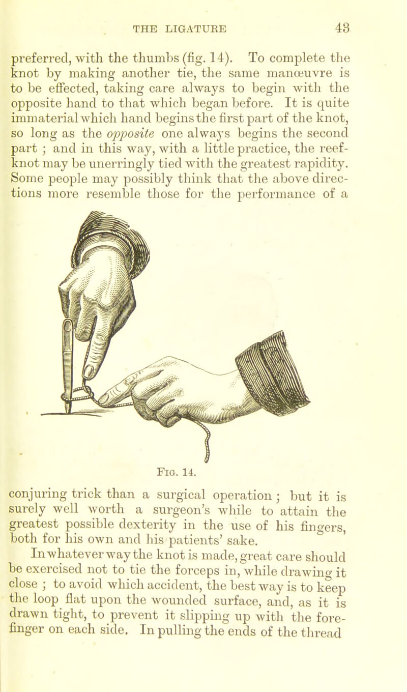 preferred, with the thumbs (fig. 14). To comiDlete the knot by making another tie, the same manoeuvre is to be effected, taking care always to begin with the opposite hand to that which began before. It is quite immaterial which hand begins the first part of the knot, so long as the opjjosite one always begins the second part ; and in this way, with a little practice, the reef- knot may be unerringly tied with the greatest rapidity. Some people may possibly think that the above direc- tions more resemble those for the performance of a Fig. 14. conjuring trick than a surgical operation; but it is surely well worth a surgeon's while to attain the greatest possible dexterity in the use of his fingers, both for his own and his patients' sake. In whatever way the knot is made, great care should be exercised not to tie the forceps in, while drawino- it close ; to avoid which accident, the best way is to keep the loop flat upon the wounded surface, and, as it is drawn tight, to prevent it slipping up with the fore- finger on each side. In pulling the ends of the thread