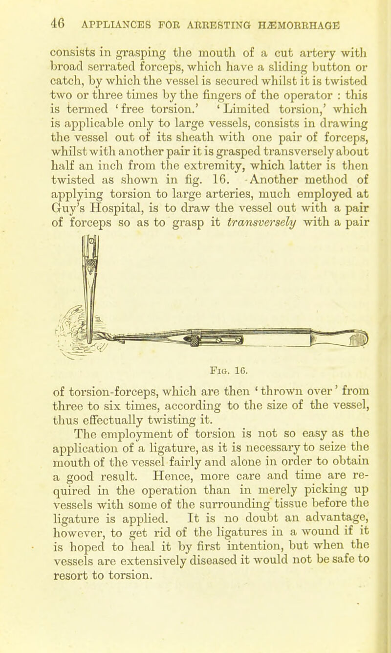 consists in grasping the mouth of a cut artery with broad serrated forceps, which have a sliding button or catch, by which the vessel is secured whilst it is twisted two or three times by the fingers of the operator : this is termed ' free torsion.' ' Limited torsion,' which is applicable only to large vessels, consists in drawing the vessel out of its sheath with one pair of forceps, whilst with another pair it is grasped transversely about half an inch from the extremity, which latter is then twisted as shown in fig. 16. Another method of applying torsion to large arteries, much employed at Guy's Hospital, is to draw the vessel out with a pair of forceps so as to grasp it transversely with a pair Fig. 16. of torsion-forceps, which are then ' thrown over' from three to six times, according to the size of the vessel, thus efiectually twisting it. The employment of torsion is not so easy as the application of a ligature, as it is necessary to seize the mouth of the vessel fairly and alone in order to obtain a good result. Hence, more care and time are re- quired in the operation than in merely picking up vessels with some of the surrounding tissue before the ligature is applied. It is no doubt an advantage, however, to get rid of the ligatures in a wound if it is hoped to heal it by first intention, but when the vessels are extensively diseased it would not be safe to resort to torsion.