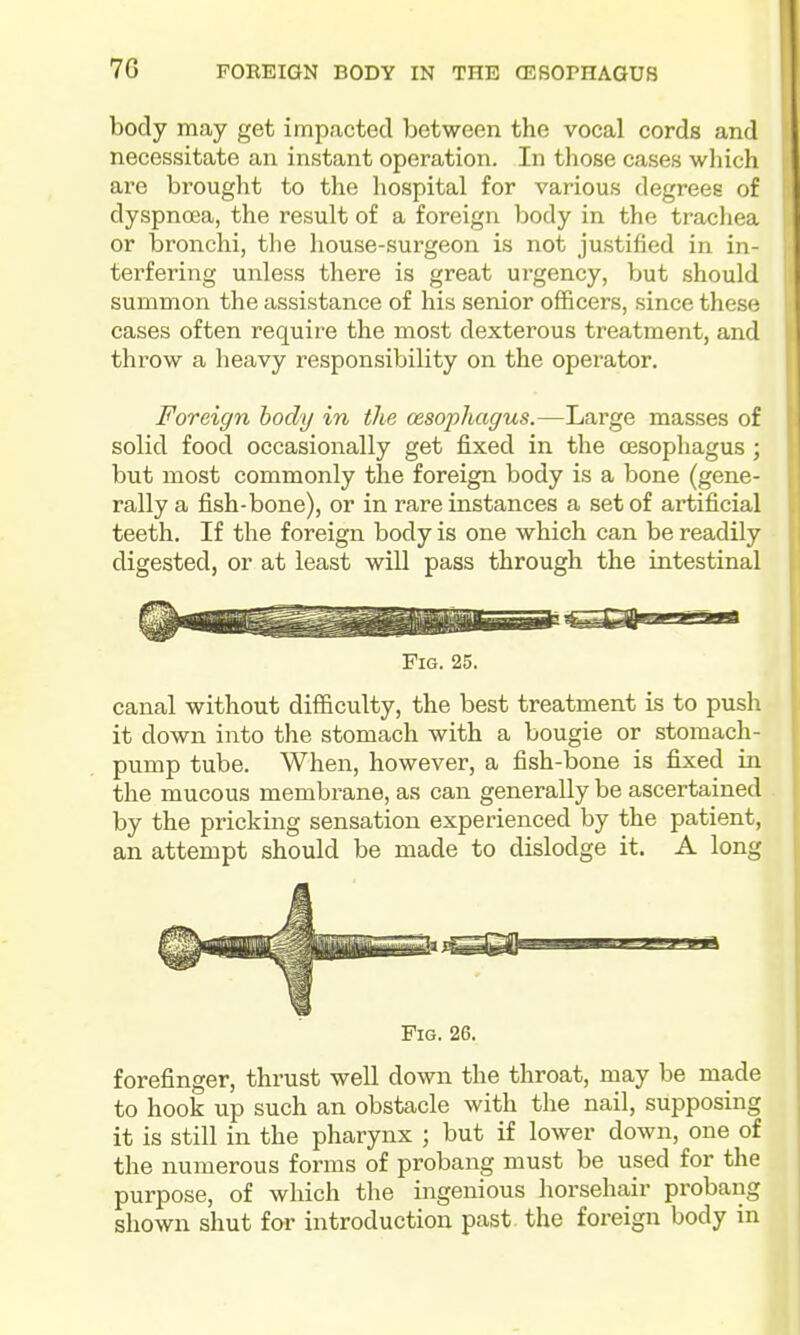 body may get impacted between the vocal cords and necessitate an instant operation. In tliose cases wliich are brought to the hospital for various degrees of dyspnoea, the result of a foreign body in the trachea or bronchi, tlie house-surgeon is not justified in in- terfering unless there is great urgency, but should summon the assistance of his senior officers, since these cases often require the most dexterous treatment, and throw a heavy responsibility on the operator. Foreign body in the oesophagus.—Large masses of solid food occasionally get fixed in the oesophagus ; but most commonly the foreign body is a bone (gene- rally a fish-bone), or in rare instances a set of artificial teeth. If the foreign body is one which can be readily digested, or at least will pass through the intestinal Fig. 25. canal without difficulty, the best treatment is to push it down into the stomach with a bougie or stomach- pump tube. When, however, a fish-bone is fixed in the mucous membrane, as can generally be ascertained by the pricking sensation experienced by the patient, an attempt should be made to dislodge it. A long Fig. 26. forefinger, thrust well down the throat, may be made to hook up such an obstacle with the nail, supposing it is still in the pharynx ; but if lower down, one of the numerous forms of probang must be used for the purpose, of which the ingenious horsehair probang shown shut for introduction past, the foreign body in