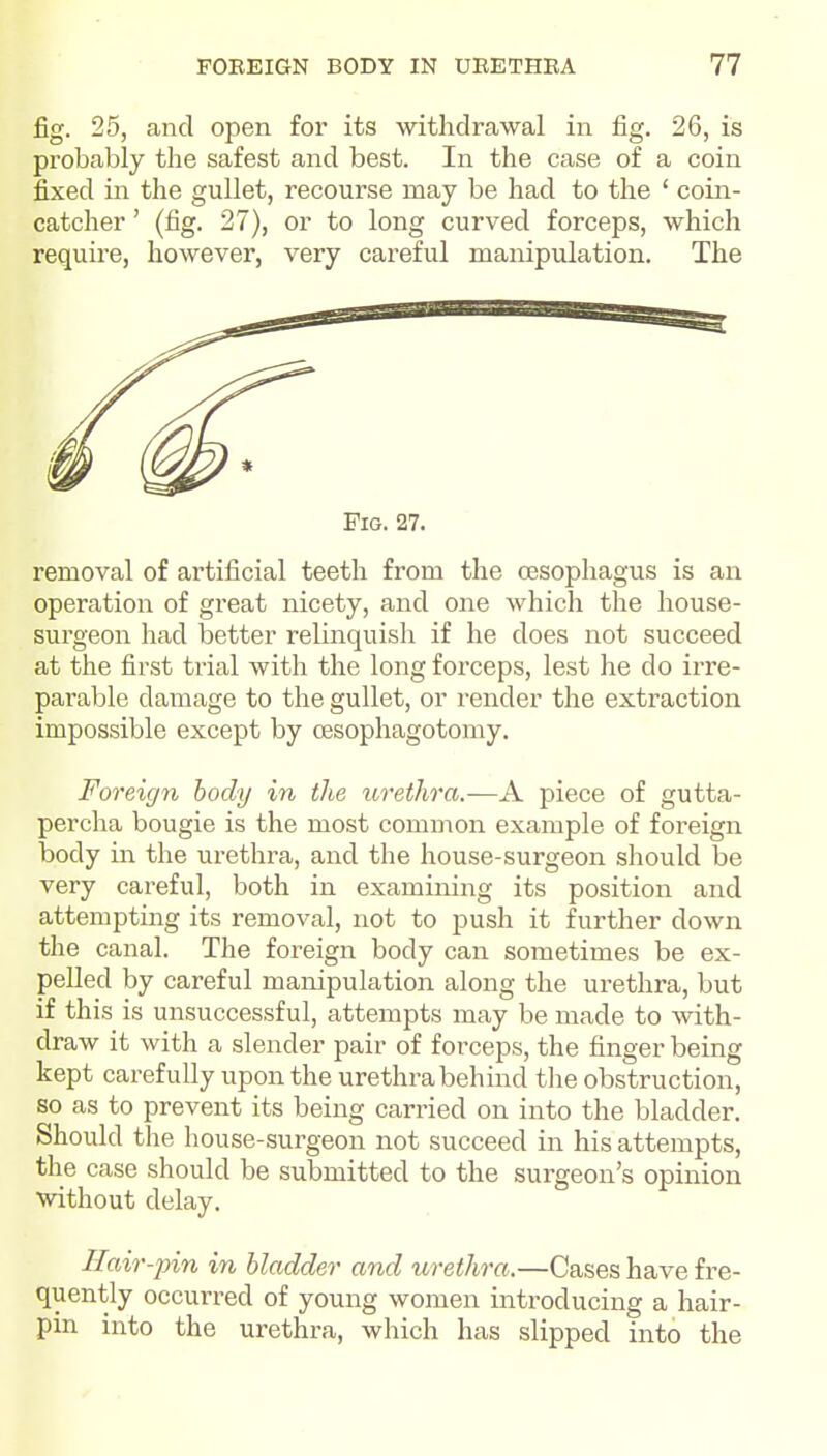 fig. 25, and open for its withdrawal in fig. 26, is probably the safest and best. In the case of a coin fixed in the gullet, recourse may be had to the ' coin- catcher ' (fig. 27), or to long curved forceps, which require, however, very careful manipulation. The Fig. 27. removal of artificial teeth from the oesophagus is an operation of great nicety, and one which the house- surgeon had better relinquish if he does not succeed at the first trial with the long forceps, lest he do irre- parable damage to the gullet, or render the extraction impossible except by cesophagotomy. Foreign body in the urethra.—A piece of gutta- percha bougie is the most common example of foreign body in the urethra, and the house-surgeon should be very careful, both in examining its position and attempting its removal, not to push it further down the canal. The foreign body can sometimes be ex- pelled by careful manipulation along the urethra, but if this is unsuccessful, attempts may be made to with- draw it with a slender pair of forceps, the finger being kept carefully upon the urethra behind tlie obstruction, so as to prevent its being carried on into the bladder. Should the house-surgeon not succeed in his attempts, the case should be submitted to the surgeon's opinion ■without delay. Hair-pin in bladder and urethra.—Cases have fre- quently occuiTed of young women introducing a hair- pin into the urethra, which has slipped into the