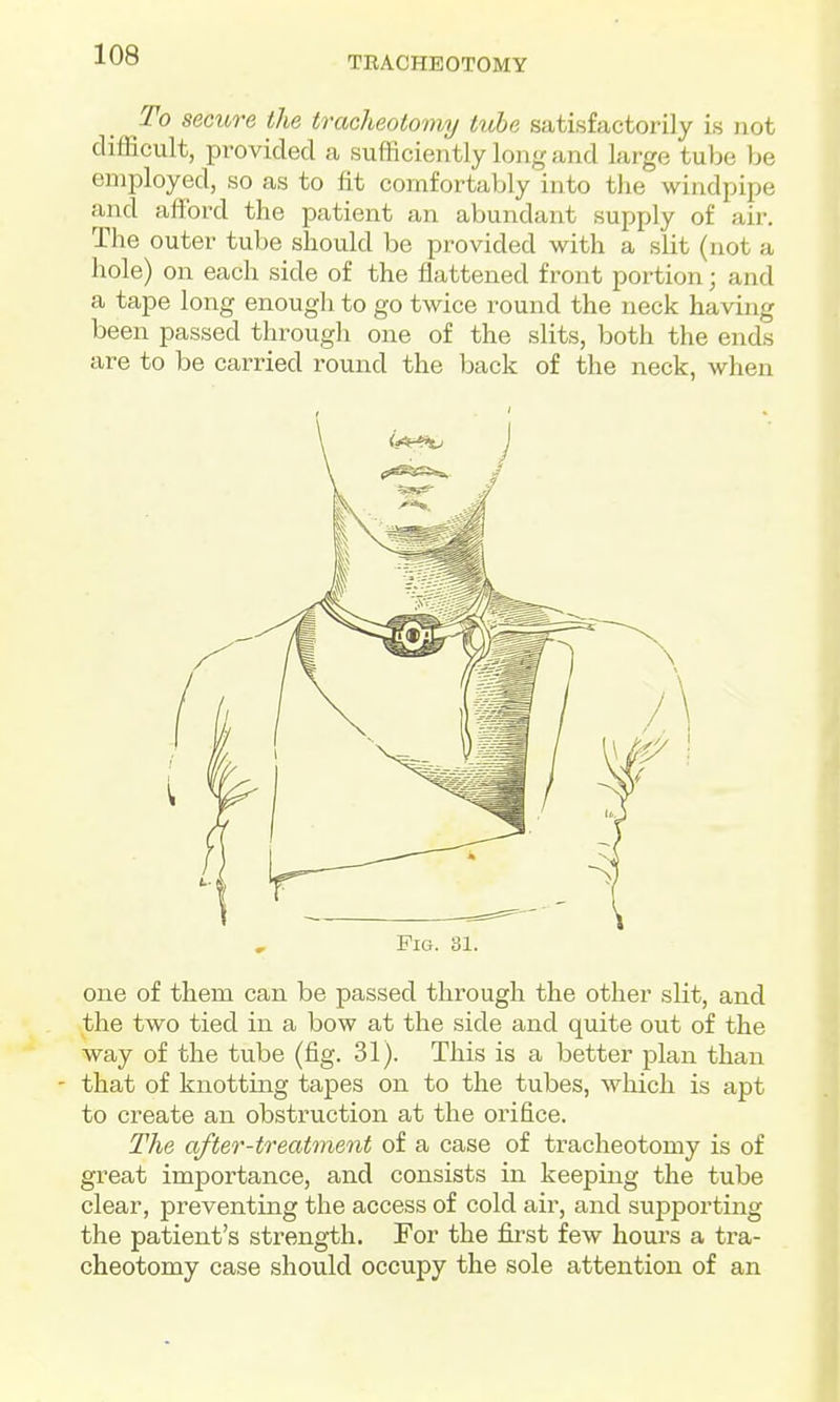 TEACHEOTOMY To secure the tracheotomy tvhe satisfactorily is not difficult, provided a sufficiently long and large tube be employed, so as to fit comfortably into the windpipe and afford the patient an abundant supply of air. The outer tube should be provided with a slit (not a hole) on each side of the flattened front portion; and a tape long enough to go twice round the neck having been passed through one of the slits, both the ends are to be carried round the back of the neck, when Fig. 31. one of them can be passed through the other slit, and the two tied in a bow at the side and quite out of the way of the tube (fig. 31). This is a better plan than - that of knotting tapes on to the tubes, which is apt to create an obstruction at the orifice. The after-treatment of a case of tracheotomy is of great importance, and consists in keeping the tube clear, preventing the access of cold air, and supporting the patient's strength. For the fibrst few hours a tra- cheotomy case should occupy the sole attention of an