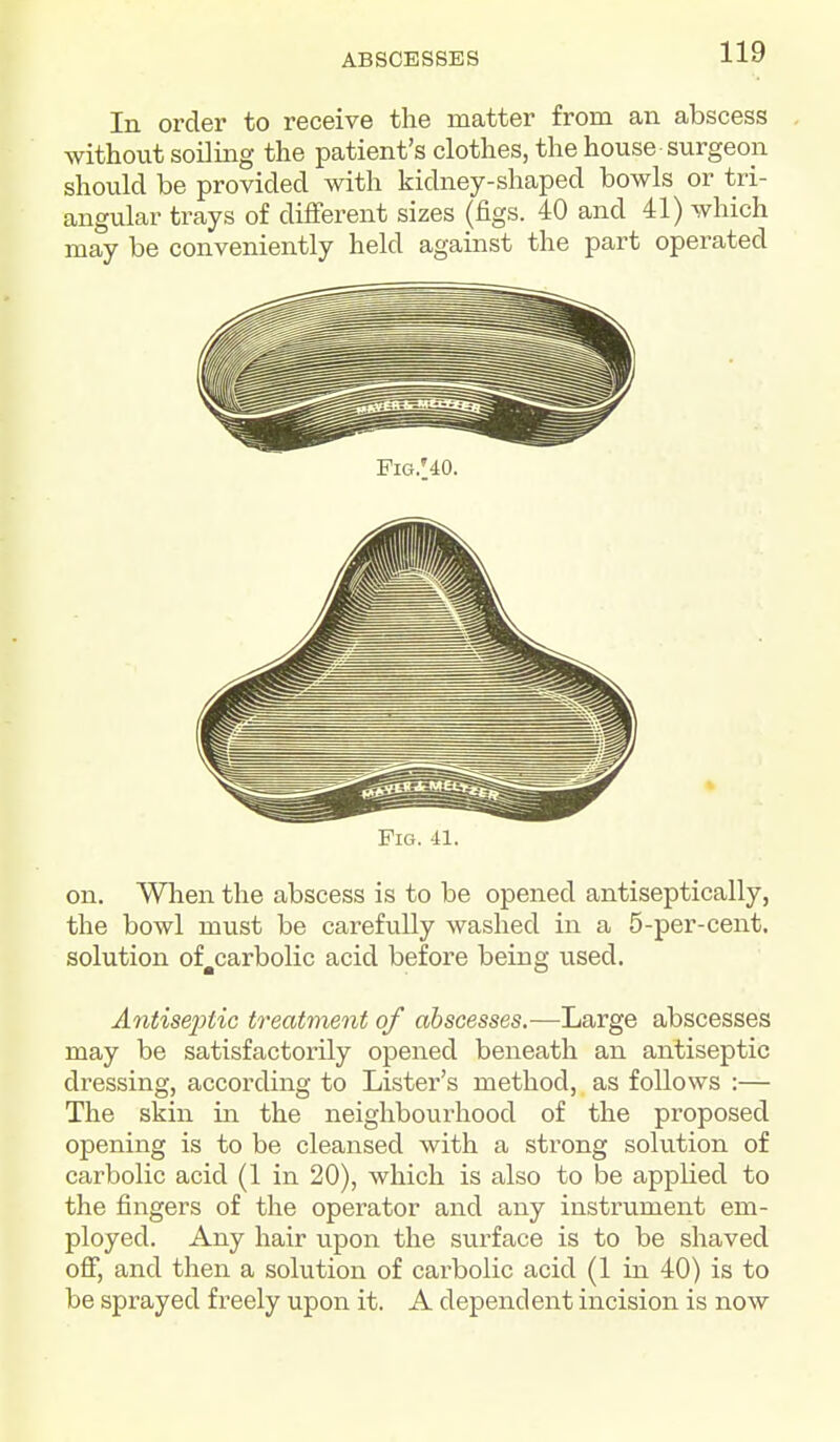 In order to receive the matter from an abscess without soiling the patient's clothes, the house surgeon should be provided with kidney-shaped bowls or tri- angular trays of different sizes (figs. 40 and 41) which may be conveniently held against the part operated Fig. 41. on. When the abscess is to be opened antiseptically, the bowl must be carefully washed in a 5-per-cent. solution of^carbolic acid before being used, AntisejJtic treatment of abscesses.—Large abscesses may be satisfactorily opened beneath an antiseptic dressing, according to Lister's method, as follows :— The skin in the neighbourhood of the proposed opening is to be cleansed with a strong solution of carbolic acid (1 in 20), which is also to be applied to the fingers of the operator and any instrument em- ployed. Any hair upon the surface is to be shaved off, and then a solution of carbolic acid (1 in 40) is to be sprayed freely upon it. A dependent incision is now