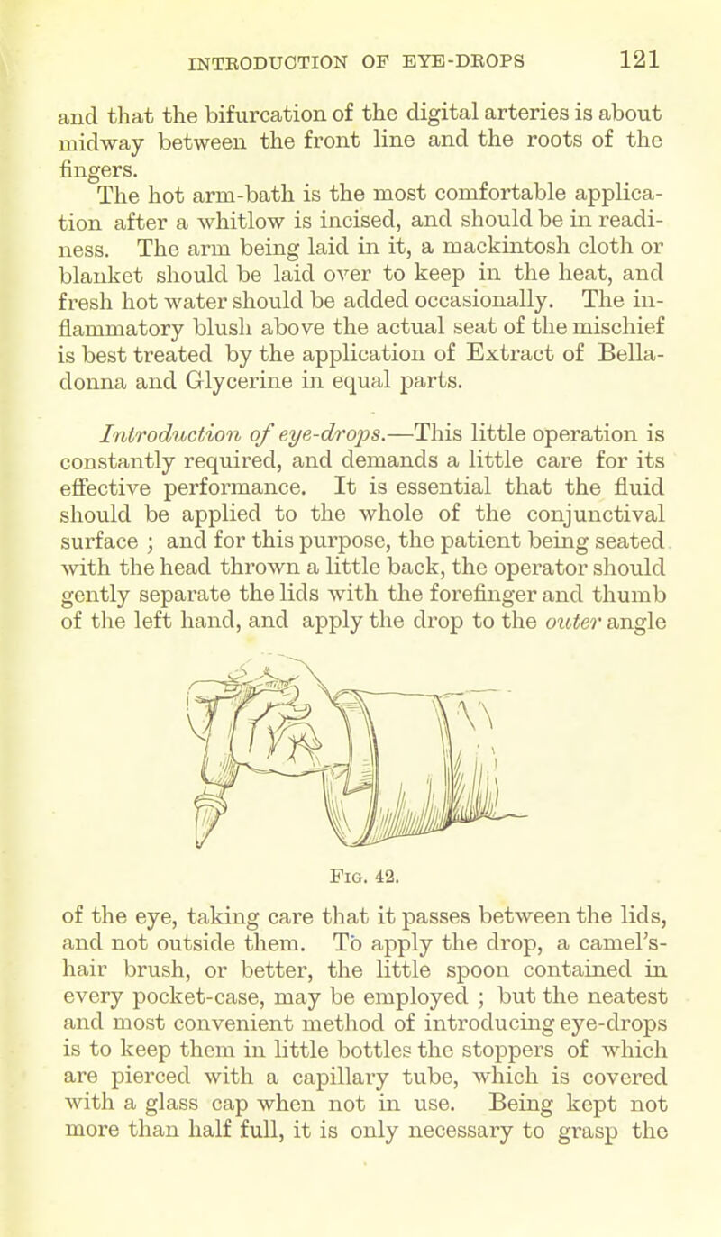 and that the bifurcation of the digital arteries is about midway between the front line and the roots of the fingers. The hot arm-bath is the most comfortable applica- tion after a whitlow is incised, and should be in readi- ness. The arm being laid in it, a mackintosh cloth or blanket should be laid over to keep in the heat, and fresh hot water should be added occasionally. The in- flammatory blush above the actual seat of the mischief is best treated by the application of Extract of Bella- donna and Glycerine in equal parts. Introduction of eye-drops.—This little operation is constantly required, and demands a little care for its effective performance. It is essential that the fluid should be applied to the whole of the conjunctival surface ; and for this purpose, the patient being seated. Avith the head thrown a little back, the operator should gently separate the lids with the forefinger and thumb of the left hand, and apply the drop to the outer angle Pig. 42. of the eye, taking care that it passes between the lids, and not outside them. To apply the drop, a camel's- hair brush, or better, the little spoon contained in every pocket-case, may be employed ; but the neatest and most convenient method of introducing eye-drops is to keep them in little bottles the stoppers of which are pierced with a capillaiy tube, which is covered with a glass cap when not in use. Being kept not more than half full, it is only necessary to grasp the