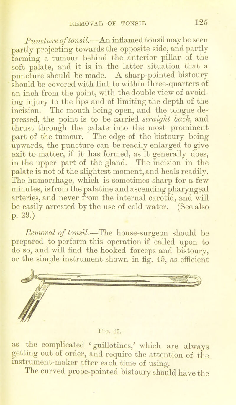 Puncture of tonsil.—Aii inflamed tonsil may be seen partly projecting towards the opposite side, and partly forming a tumour behind the anterior pillar of the soft palate, and it is in the latter situation that a puncture should be made. A sharp-pointed bistoury should be covered with lint to within three-quarters of an inch from the point, with the double view of avoid- ing injury to the lips and of limiting the depth of the incision. The mouth being open, and the tongue de- pressed, the point is to be carried straight hack, and thrust through the palate into the most prominent part of the tumour. The edge of the bistoury being upwards, the puncture can be readily enlarged to give exit to matter, if it has formed, as it generally does, in the upper part of the gland. The incision in the palate is not of the slightest moment, and heals readily. The hfemorrhage, which is sometimes sharp for a few minutes, is from the palatine and ascending pharyngeal arteries, and never from the internal carotid, and will be easily arrested by the use of cold water. (See also p. 29.) Removal of tonsil.—The house-surgeon should be prepared to perform this operation if called upon to do so, and will find the hooked forceps and bistoury, or the simple instrument shown in fig. 45, as efficient Fio. 45. as the complicated 'guillotines,' which are always getting out of order, and require the attention of the instrument-maker after each time of using. The curved probe-pointed bistoury should have the