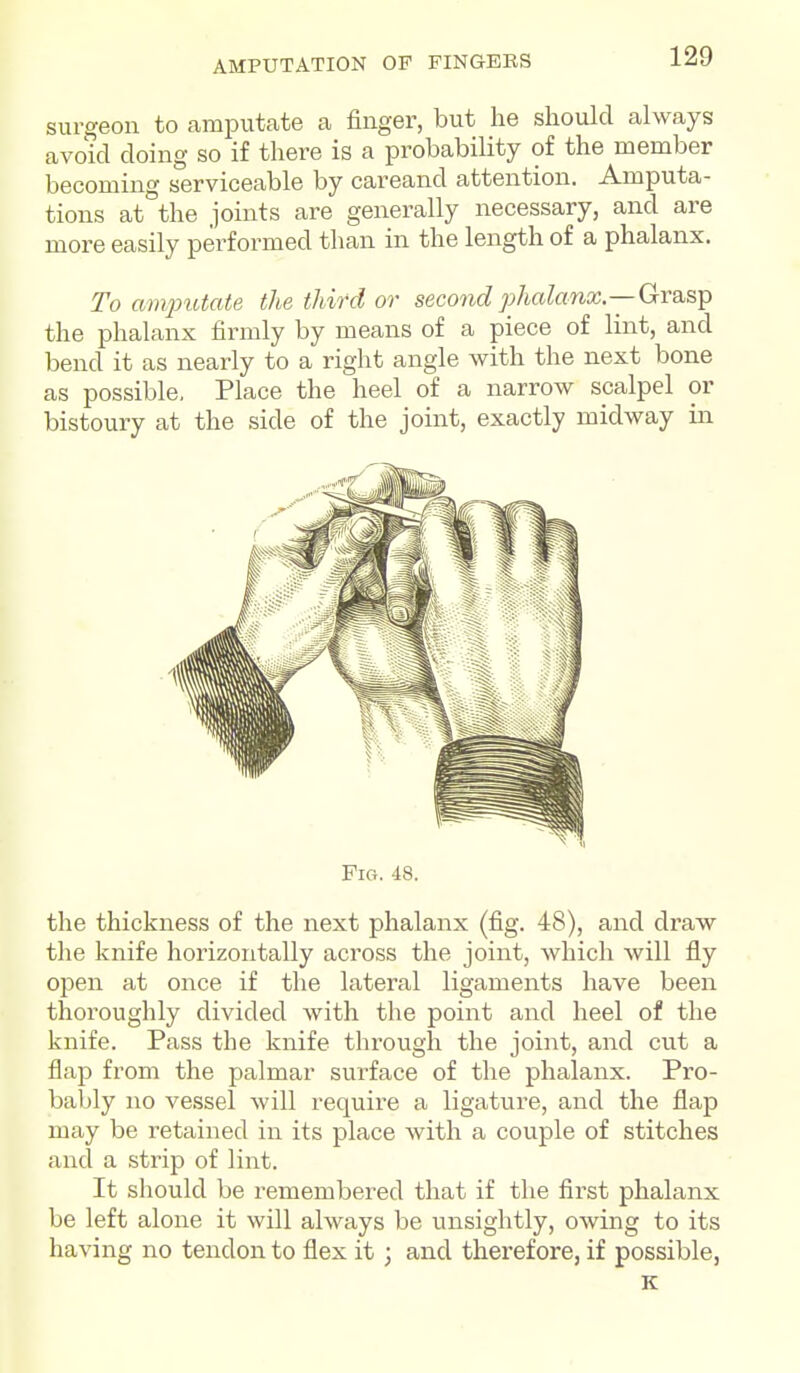 surgeon to amputate a finger, but he should always avoid doing so if there is a probability of the member becoming serviceable by careand attention. Amputa- tions at the joints are generally necessary, and are more easily performed than in the length of a phalanx. To amjnUate the third or second phalanx—GrasTp the phalanx firmly by means of a piece of lint, and bend it as nearly to a right angle with the next bone as possible, Place the heel of a narrow scalpel or bistoury at the side of the joint, exactly midway in the thickness of the next phalanx (fig. 48), and draw the knife horizontally across the joint, which will fly open at once if the lateral ligaments have been thoroughly divided with the point and heel of the knife. Pass the knife through the joint, and cut a flap from the palmar surface of the phalanx. Pro- bably no vessel will require a ligature, and the flap may be retained in its place with a couple of stitches and a strip of lint. It should be remembered that if the flrst phalanx be left alone it will always be unsightly, owing to its having no tendon to flex it; and therefore, if possible, K i Fio. 48.