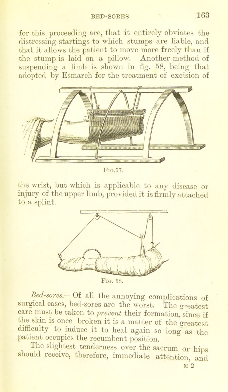 for this proceeding are, that it entirely obviates the distressing startings to which stumps are Hable, and that it allows the patient to move more freely than if the stump is laid on a pillow. Another method of suspending a limb is shown in fig. 58, being that adopted by Esmarch for the treatment of excision of FiG.57. the wrist, but which is applicable to any disease or injury of the upper limb, provided it is firmly attached to a splint. Fig. 58. Bed-sores.—Of all the annoying complications of surgical cases, bed-sores are the worst. The greatest care must be taken to prevent their formation.'^since if the skin is once broken it is a matter of the greatest difficulty to induce it to heal again so long as the patient occupies the recumbent position. The slightest tenderness over the sacrum or hips should receive, therefore, immediate attention, and M 2