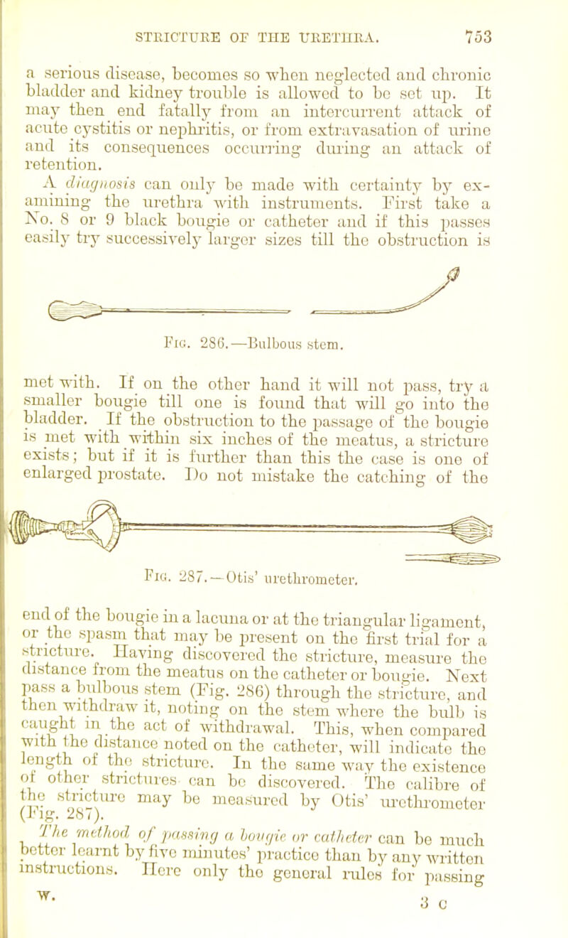 a serious disease, becomes so wlien neglected and clironic bladder and kidney trouble is allowed to be set up. It may tlien_ end fatally from an interciu'rent attack of acute cystitis or nephi-itis, or from extravasation of urine and its consequences occuriing during an attack of retention. A diagnosis can only be made with certainty by ex- amining the urethra with, instruments. First take a No. 8 or 9 black bougie or catheter and if this passes easily try successively larger sizes till the obstruction is Fig. 286.—Bulbous Ktem. met with. If on the other hand it will not pass, try a .smaller bougie till one is found that will go into the bladder. _ If the obstruction to the passage of the bougie is met with within six inches of the meatus, a stricture exists; but if it is further than this the case is one of enlarged i^rostate. Do not mistake the catching of the Fig. 287. —Otis' lU'etlirometer. end of the bougie in a lacuna or at the triangular ligament, or the spasm that may be present on the first trial for a stricture. Having discovered the stricture, measure the distance from the meatus on the catheter or bougie. Next pass a bulbous stem (Fig. 286) through the stricture, and then withdraw it, noting on the stem where the bulb is caught m the act of withdrawal. This, when compared with the distance noted on the catheter, will indicate the length of the stricture. In the same way the existence of other strictures can bo discovered. The calibre of the .stricture may be measured by Otis' urcthrometer (I'lg. 28/). The metJiod of passing a hovqic. or mt/idar can be much bettor leamt by five minutes' practice than by any written instructions. Here only the general rules for passing