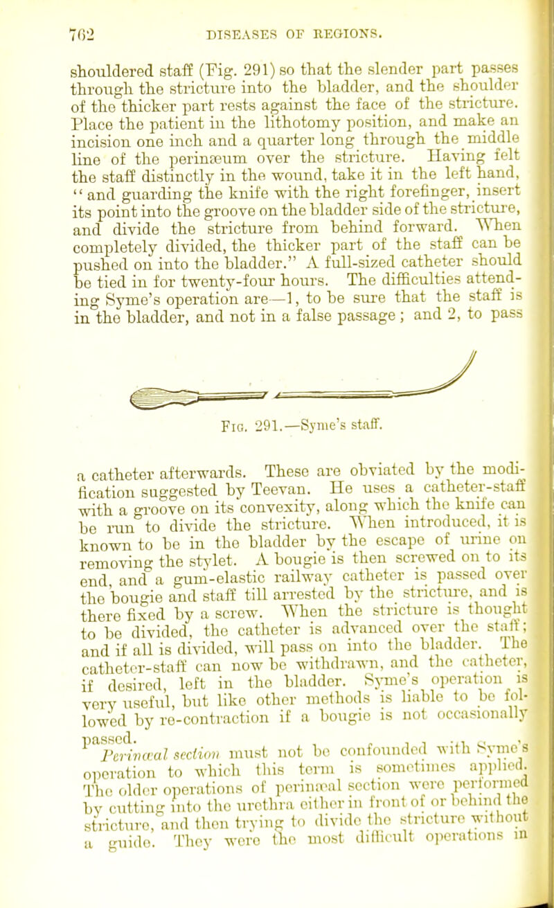 shouldered staff (Fig. 291) so that the slender part passes through the stricture into the bladder, and the shoulder of the thicker part rests against the face of the stricture. Place the patient in the lithotomy position, and make an incision one inch and a quarter long through the middle line of the perinseum over the stricture. Having felt the staff distinctly in the wound, take it in the left hand.  and guarding the knife with the right forefinger, insert its point into the groove on the bladder side of the strictm-e, and divide the stricture from behind forward. TSTien completely divided, the thicker part of the staff can be pushed on into the bladder. A full-sized catheter should be tied in for twenty-four hours. The difficulties attend- ing Syme's operation are—1, to be sm-e that the staff is in the bladder, and not in a false passage ; and 2, to pas:. Fig. 291.—Syme's staff. a catheter afterwards. These are obviated by the modi- fication suggested by Teevan. He uses a catheter-staff with a groove on its convexity, along which the knife can be run to divide the stricture. ^Mien introduced, it is known to be in the bladder by the escape of unne on removing the stjdet. A bougie is then screwed on to its end and a guui-elastic railway catheter is passed over the bougie and staff till arrested by the stnctiu-e, and is there fixed by a screw. When the stricture is thought to be divided, the catheter is advanced over the staff; and if all is divided, ^\'ill pass on into the bladder. The cathetor-staff can now be withdrawn, and the catheter, if desired, left in tho bladder. Syme's operation is very useful, hut like other methods is liable to be fol- lowed by re-contraction if a bougie is not occasionally ^^^Fcrimral section must not be confounded with Syme's operation to which this term is sometimes ap]>lied The older operations of perina^^l secticm were pertoruied bv cutting into the urethra either in front of or behind the stricture, and then trying to divide the stricture without a -uido. They were the most diflicult o]>erations m